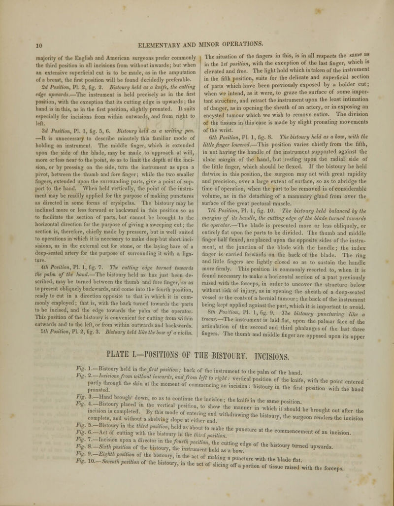 majority of the English and American surgeons prefer commonly the third position in all incisions from without inwards; but when an extensive superficial cut is to be made, as in the amputation of a breast, the first position will be found decidedly preferable. 2d Position, PI. 2, fig. 2. Bistoury held as a knife, the cutting $4gt upwards.—The instrument is held precisely as in the first position, with the exception that its cutting edge is upwards ; the hand is in this, as in the first position, slightly pronated. It suits cially for incisions from within outwards, and from right to left. 3d Position, PI. 1, fig. 5, 6. Bistoury held as a writing pen. —It is unnecessary to describe minutely this familiar mode of holding an instrument. The middle finger, which is extended upon the side of the blade, may be made to approach at will, more or less near to the point, so as to limit the depth of the inci- sion, or by pressing on the side, turn the instrument as upon a pivot, between the thumb and fore finger; while the two smaller lingers, extended upon the surrounding parts, give a point of sup- port to the hand. When held vertically, the point of the instru- ment may be readily applied for the purpose of making punctures as directed in some forms of erysipelas. The bistoury may be inclined more or less forward or backward in this position so as to facilitate the section of parts, but cannot be brought to the horizontal direction for the purpose of giving a sweeping cut; the section is, therefore, chiefly made by pressure, but is well suited to operations in which it is necessary to make deep but short inci- sisions, as in the external cut for stone, or the laying bare of a deep-seated artery for the purpose of surrounding it with a liga- ture. 4th Position, PI. 1, fig. 7. The cutting edge turned towards the palm of the hand.—The bistoury held as has just been de- scribed, may be turned between the thumb and fore finger, so as to present obliquely backwards, and come into the fourth position, ready to cut in a direction opposite to that in which it is com- monly employed; that is, with the back turned towards the parts to be incised, and the edge towards the palm of the operator. This position of the bistoury is convenient for cutting from within outwards and to the left, or from within outwards and backwards. bth Position, PI. 2, fig. 3. Bistoury held like the bow of a violin. The situation of the fingers in this, is in all respects the same as in the 1st position, with the exception of the last finger, which is elevated and free. The light hold which is taken of the instrument in the fifth position, suits for the delicate and superficial section of parts which have been previously exposed by a bolder cut; when we intend, as it were, to graze the surface of some impor- tant structure, and retract the instrument upon the least intimation of danger, as in opening the sheath of an artery, or in exposing an encysted tumour which we wish to remove entire. The division of the tissues in this case is made by slight pronating movements of the wrist. 6th Position, PI. 1, fig. 8. The bistoury held as a bow, with the little finger lowered.—This position varies chiefly from the fifth, in not having the handle of the instrument supported against the ulnar margin of the hand, but resting upon the radial side of the little finger, which should be flexed. If the bistoury be held flatwise in this position, the surgeon may act with great rapidity and precision, over a large extent of surface, so as to abridge the time of operation, when the part to be removed is of considerable volume, as in the detaching of a mammary gland from over the surface of the great pectoral muscle. 1th Position, PL 1, fig. 10. The bistoury held balanced by the margins of its handle, the cutting edge of the blade turned towards the operator.—The blade is presented more or less obliquely, or entirely flat upon the parts to be divided. The thumb and middle finger half flexed, are placed upon the opposite sides of the instru- ment, at the junction of the blade with the handle; the index finger is carried forwards on the back of the blade. The ring and little fingers are lightly closed so as to sustain the handle more firmly. This position is commonly resorted to, when it is found necessary to make a horizontal section of a part previously raised with the forceps, in order to uncover the structure below without risk of injury, as in opening the sheath of a deep-seated vessel or the coats of a hernial tumour; the back of the instrument being kept applied against the part, which it is important to avoid. 8th Position, PI. 1, fig. 9. The bistoury puncturing like a trocar.—The instrument is laid flat, upon the palmar face of the articulation of the second and third phalanges of the last three fingers. The thumb and middle finger are opposed upon its upper Fig. Fig. Fig. Fig. Fig. Fig. rig- Fig. JY<r. PLATE IMPOSITIONS OF THE BISTOURY. INCISIONS, 1.-Bistoury held in the first position; back of the instrument to the palm of the hand 2.—Incisions from without inwards, and from left to riant ■ vertical nnsitmn nf «\a l ■* :**. <i 3—Hand brought down, so as to continue the incision; the knife in the same position LlTSX %£££%&UJzrTrUAshou,dbebro8'■*-*• complete, and without a shelving slope at eXr e„h *'lM'™°°^ bls'»«y. *» surgeon renders (he 5.—Bistoury in the third position, held as about to make tho nrm„* * a 6.-AO of cutting with the bistonr, in the £^S£. ? ^ Mm™»< «*» vision. 7.—Incision upon a director in the fourth position the ciittit.^ ** e a ,_• $.-SiMpm,ion of the bistoury, L instLent 'held  a bow  **' * ^'^ 9-—Eighth position of the bistourv in flip wt „e ™~i • loJLi^Nta. of the bisto I in he ct 0?;' ' 7**?- ** ^ ^ *• tour,, the act of slicing off a portion of tissue raised with the forceps. ie incision