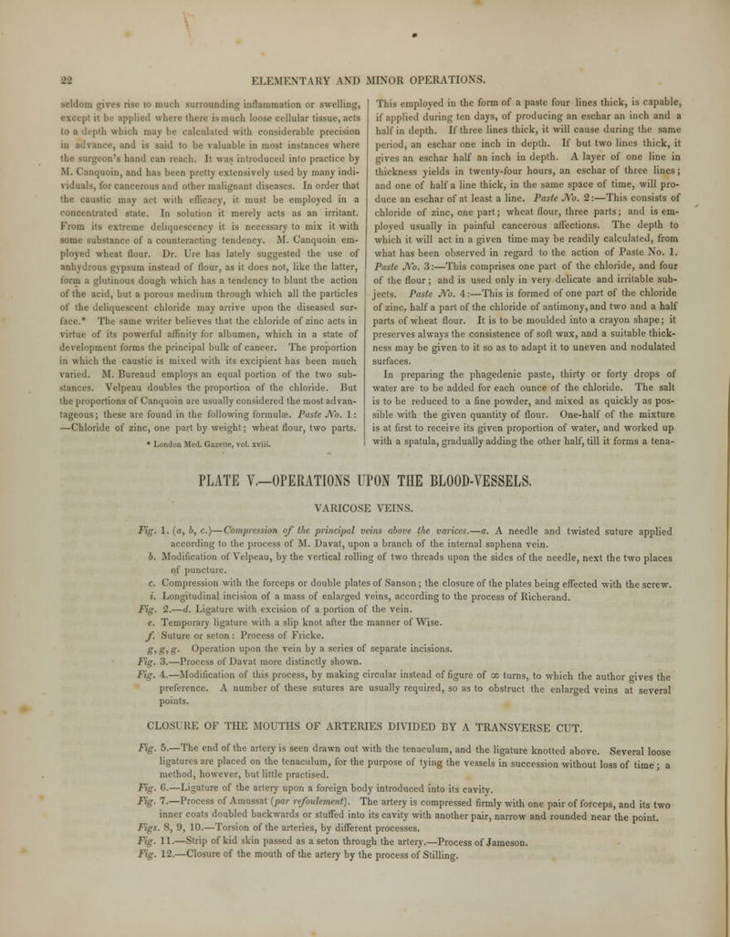 seldom gives rise to much surrounding inflammation or swelling, pi it be applied where there is much loose cellular tissue, acts depth which may be calculated with considerable precision in advance, and is said to be valuable in most instances where the surgeon's hand can reach. It was introduced into practice by M. Canquoin, and has been pretty extensively used by many indi- viduals, for cancerous and other malignant diseases. In order that the caustic may act with efficacy, it must be employed in a concentrated state. In solution it merely acts as an irritant. From its extreme deliquescency it is necessary to mix it with some substance of a counteracting tendency. M. Canquoin em- ployed wheat flour. Dr. Ure has lately suggested the use of anhydrous gypsum instead of flour, as it does not, like the latter, form a glutinous dough which has a tendency to blunt the action of the acid, but a porous medium through which all the particles of the deliquescent chloride may arrive upon the diseased sur- face.* The same writer believes that the chloride of zinc acts in virtue of its powerful affinity for albumen, which in a state of development forms the principal bulk of cancer. The proportion in which the caustic is mixed with its excipient has been much varied. M. Bureaud employs an equal portion of the two sub- stances. Velpeau doubles the proportion of the chloride. But the proportions of Canquoin are usually considered the most advan- tageous ; these are found in the following formula?. Paste No. 1: —Chloride of zinc, one part by weight; wheat flour, two parts. • London Med. Gazette, vol. xviii. This employed in the form of a paste four lines thick, is capable, if applied during ten days, of producing an eschar an inch and a half in depth. If three lines thick, it will cause during the same period, an eschar one inch in depth. If but two lines thick, it gives an eschar half an inch in depth. A layer of one line in thickness yields in twenty-four hours, an eschar of three lines; and one of half a line thick, in the same space of time, will pro- duce an eschar of at least a line. Paste No. 2:—This consists of chloride of zinc, one part; wheat flour, three parts; and is em- ployed usually in painful cancerous affections. The depth to which it will act in a given time may be readily calculated, from what has been observed in regard to the action of Paste No. 1. Paste No. 3:—This comprises one part of the chloride, and four of the flour; and is used only in very delicate and irritable sub- jects. Paste No. 4:—This is formed of one part of the chloride of zinc, half a part of the chloride of antimony, and two and a half parts of wheat flour. It is to be moulded into a crayon shape; it preserves always the consistence of soft wax, and a suitable thick- ness may be given to it so as to adapt it to uneven and nodulated surfaces. In preparing the phagedenic paste, thirty or forty drops of water are to be added for each ounce of the chloride. The salt is to be reduced to a fine powder, and mixed as quickly as pos- sible with the given quantity of flour. One-half of the mixture is at first to receive its given proportion of water, and worked up with a spatula, gradually adding the other half, till it forms a tena- PLATE V.—OPERATIONS UPON THE BLOOD-VESSELS. VARICOSE VEINS. Fig. 1. (a, b, c.)—Compression of the principal veins above the varices.—a. A needle and twisted suture applied according to the process of M. Davat, upon a branch of the internal saphena vein. b. Modification of Velpeau, by the vertical rolling of two threads upon the sides of the needle, next the two places of puncture. c. Compression with the forceps or double plates of Sanson; the closure of the plates being effected with the screw. i. Longitudinal incision of a mass of enlarged veins, according to the process of Richerand. Fig. 2.—d. Ligature with excision of a portion of the vein. e. Temporary ligature with a slip knot after the manner of Wise. f. Suture or seton : Process of Fricke. g, g, g. Operation upon the vein by a series of separate incisions. Fig. 3.—Process of Davat more distinctly shown. Fig. 4.—Modification of this process, by making circular instead of figure of go turns, to which the author gives the preference. A number of these sutures are usually required, so as to obstruct the enlarged veins at several points. CLOSURE OF THE MOUTHS OF ARTERIES DIVIDED BY A TRANSVERSE CUT. Fig. 5.—The end of the artery is seen drawn out with the tenaculum, and the ligature knotted above. Several loose ligatures are placed on the tenaculum, for the purpose of tying the vessels in succession without loss of time; a method, however, but little practised. Fig. 6.—Ligature of the artery upon a foreign body introduced into its cavity. Fig. 7.—Process of Amussat (par refoulement). The artery is compressed firmly with one pair of forceps, and its two inner coats doubled backwards or stuffed into its cavity with another pair, narrow and rounded near the point. Figs. 8, 9, 10.—Torsion of the arteries, by different processes. Fig. 11.—Strip of kid skin passed as a seton through the artery.—Process of Jameson. Fig. 12.—Closure of the mouth of the artery by the process of Stilling.