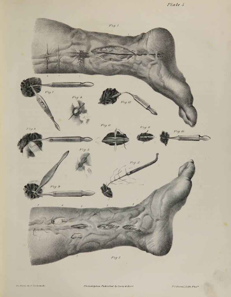 ?>:•..•- Fig / OnJtlont />>'■>' CichOH/sJki