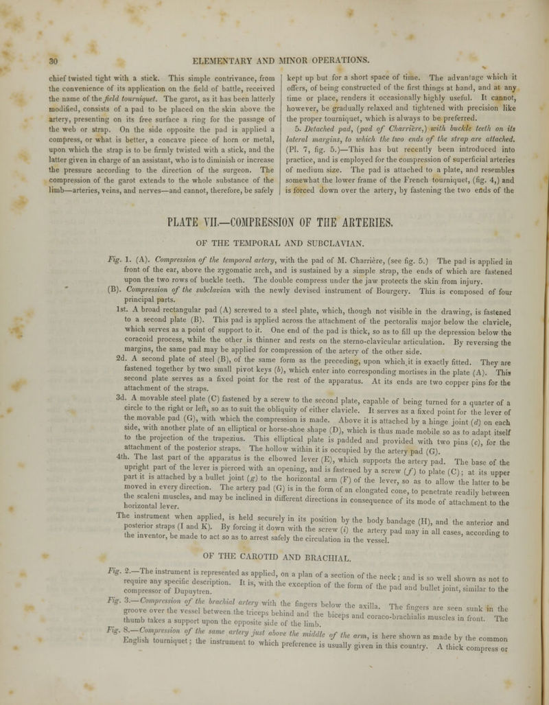 chief twisted tight with a stick. This simple contrivance, from the convenience of its application on the field of battle, received the name of the field tourniquet. The garot, as it has been latterly modified, consists of a pad to be placed on the skin above the artery, presenting on its free surface a ring for the passage of the web or strap. On the side opposite the pad is applied a compress, or what is better, a concave piece of horn or metal, upon which the strap is to be firmly twisted with a stick, and the latter given in charge of an assistant, who is to diminish or increase the pressure according to the direction of the surgeon. The compression of the garot extends to the whole substance of the limb—arteries, veins, and nerves—and cannot, therefore, be safely kept up but for a short space of time. The advantage which it offers, of being constructed of the first things at hand, and at any time or place, renders it occasionally highly useful. It cannot, however, be gradually relaxed and tightened with precision like the proper tourniquet, which is always to be preferred. 5. Detached pad, (pad of Charriere,) with buckle teeth on its lateral margins, to which the two ends of the strap are attached. (PI. 7, fig. 5.)—This has but recently been introduced into practice, and is employed for the compression of superficial arteries of medium size. The pad is attached to a plate, and resembles somewhat the lower frame of the French tourniquet, (fig. 4,) and is forced down over the artery, by fastening the two ends of the PLATE VII.—COMPRESSION OF THE ARTERIES. OF THE TEMPORAL AND SUBCLAVIAN. Fig. 1. (A). Compression of the temporal artery, with the pad of M. Charriere, (see fig. 5.) The pad is applied in front of the ear, above the zygomatic arch, and is sustained by a simple strap, the ends of which are fastened upon the two rows of buckle teeth. The double compress under the jaw protects the skin from injury. (B). Compression of the subclavian with the newly devised instrument of Bourgery. This is composed of four principal parts. 1st. A broad rectangular pad (A) screwed to a steel plate, which, though not visible in the drawing, is fastened to a second plate (B). This pad is applied across the attachment of the pectoralis major below the clavicle, which serves as a point of support to it. One end of the pad is thick, so as to fill up the depression below the coracoid process, while the other is thinner and rests on the. sternoclavicular articulation. By reversing the margins, the same pad may be applied for compression of the artery of the other side. 2d. A second plate of steel (B), of the same form as the preceding, upon which it is exactly fitted. They are fastened together by two small pivot keys (b), which enter into corresponding mortises in the plate (A) This second plate serves as a fixed point for the rest of the apparatus. At its ends are two copper pins for the attachment of the straps. 3d. A movable steel plate (C) fastened by a screw to the second plate, capable of being turned for a quarter of a circle to the right or left, so as to suit the obliquity of either clavicle. It serves as a fixed point for the lever of the movable pad (G), with which the compression is made. Above it is attached by a hinge joint (d) on each side with another plate of an elliptical or horse-shoe shape (D), which is thus made mobile so as to adapt itself to the projection of the trapezius. This elliptical plate is padded and provided with two pins (c) for the attachment of the posterior straps. The hollow within it is occupied by the artery pad (G) 4th. The last part of the apparatus is the elbowed lever (E), which supports the artery pad. The base of the upright part of the lever is pierced with an opening, and is fastened by a screw (/) to plate (C) • at its upper part it is attached by a bullet joint (g) to the horizontal arm (F) of the lever, so as to allow the latter to be moved in every direction. The artery pad (G) is in the form of an elongated cone, to penetrate readily between LZ^nZ7 ' ma> m diffCrent direCti°nS hl COnse^ence of * -ode of attachment to the Ttsno:nsT?daKf edB isrheld sr;rely in L\position hy the bod>- ^^ &> ** ** «*«*» ** postenor straps (I and K). By forcing it down with the screw (i) the artery pad may in all cases according to the inventor, be made to act so as to arrest safely the circulation in the vessel. according to OF THE CAROTID AND BRACHIAL. Fig' ^J^SZS^u^Ca plan of a section of the neck; and is so we]1 sho- «not to co'mTessor TSn^T ' ^ ^ ^^ °' *» ta °f the ^ ™* bullet joint, similar to the Fig. 3.—Compression of the brachial artery with the Sneers below the avills, TV r . . , groove over the vessel between the triceps behind and thP 1 , ^ * ^ SUk ,n the ?hnn>h taWc , 1 P d the blcePs and coraco-brachialis muscles in front The thumb takes a support upon the opposite side of the limb. Fig. 8.—Compression of the same artery just above the miihllo nf th„ ■ v ' x. r. „,• . 7 ., . a J uoe im m*uaie oj the arm, is here shown as made bv the rnmmnn English tourniquet; the instrument to which preferencp ^ n.noii ■ • a- * ^oyuiecomraon Nvmcn preierence is usually given in this country. A thick compress or