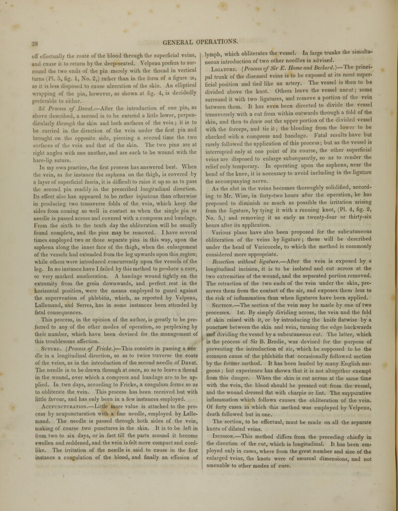 off effectually the route of the blood through the superficial veins, and cause it to return by the deep-seated. Velpeau prefers to sur- round the two ends of the pin merely with the thread in vertical turns (PI. 5, fig. 1, No. 2,) rather than in the form of a figure oo, as it is less disposed to cause ulceration of the skin. An elliptical wrapping of the pin, however, as shown at fig. 4, is decidedly preferable to either. Process of Davat.—After the introduction of one pin, as above described, a second is to be entered a little lower, perpen- dicularly through the skin and both surfaces of the vein ; it is to be carried in the direction of the vein under the first pin and brought on the opposite side, piercing a second time the two surfaces of the vein and that of the skin. The two pins are at right angles with one another, and are each to be wound with the hare-lip suture. In my own practice, the first process has answered best. When the vein, as for instance the saphena on the thigh, is covered by a layer of superficial fascia, it is difficult to raise it up so as to pass the second pin readily in the prescribed longitudinal direction. Its effect also has appeared to be rather injurious than otherwise in producing two transverse folds of the vein, which keep the sides from coming so well in contact as when the single pin or needle is passed across and covered with a compress and bandage. From the sixth to the tenth day the obliteration will be usually found complete, and the pins may be removed. I have several times employed two or three separate pins in this way, upon the saphena along the inner face of the thigh, when the enlargement of the vessels had extended from the leg upwards upon this region; while others were introduced concurrently upon the vessels of the leg. In no instance have I failed by this method to produce a cure, or very marked amelioration. A bandage wound tightly on the extremity from the groin downwards, and perfect rest in the horizontal position, were the means employed to guard against the supervention of phlebitis, which, as reported by Velpeau, Lallemand, and Serres, has in some instances been attended by fatal consequences. This process, in the opinion of the author, is greatly to be pre- ferred to any of the other modes of operation, so perplexing by their number, which have been devised for the management of this troublesome affection. Suture. (Process of Fricke.)—This consists in passing a nee die in a longitudinal direction, so as to twice traverse the coats of the veins, as in the introduction of the second needle of Davat. The needle is to be drawn through at once, so as to leave a thread in the wound, over which a compress and bandage are to be ap- plied. In two days, according to Fricke, a coagulum forms so as to obliterate the vein. This process has been received but with little favour, and has only been in a few instances employed. Acupuncturation.—Little more value is attached to the pro- cess by acupuncturation with a fine needle, employed by Lalle- mand. The needle is passed through both sides of the vein, making of course two punctures in the skin. It is to be left in from two to six days, or in fact till the parts around it become swollen and reddened, and the vein is felt more compact and cord- like. The irritation of the needle is said to cause in the first instance a coagulation of the blood, and finally an effusion of GENERAL OPERATIONS. lymph, which obliterates the vessel. In large trunks the simulta- neous introduction of two other needles is advised. Ligature. (Process of Sir E. Home and Beclard.)—The princi- pal trunk of the diseased veins is to be exposed at its most super- ficial position and tied like an artery. The vessel is then to be divided above the knot. Others leave the vessel uncut; some surround it with two ligatures, and remove a portion of the vein between them. It has even been directed to divide the vessel transversely with a cut from within outwards through a fold of the skin, and then to draw out the upper portion of the divided vessel with the forceps, and tie it; the bleeding from the lower to be checked with a compress and bandage. Fatal results have but rarely followed the application of this process; but as the vessel is interrupted only at one point of its course, the other superficial veins are disposed to enlarge subsequently, so as to render the relief only temporary. In operating upon the saphena, near the bend of the knee, it is necessary to avoid including in the ligature the accompanying nerve. As the clot in the veins becomes thoroughly solidified, accord- ing to Mr. Wise, in forty-two hours after the operation, he has proposed to diminish as much as possible the irritation arising from the ligature, by tying it with a running knot, (PI. 4, fig. 2, No. 5,) and removing it as early as twenty-four or thirty-six hours after its application. Various plans have also been proposed for the subcutaneous obliteration of the veins by ligature ; these will be described under the head of Varicocele, to which the method is commonly considered more appropriate. Resection without ligature.—After the vein is exposed by a longitudinal incision, it is to be isolated and cut across at the two extremities of the wound, and the separated portion removed. The retraction of the two ends of the vein under the skin, pre- serves them from the contact of the air, and exposes them less to the risk of inflammation than when ligatures have been applied. Section.—The section of the vein may be made by one of two processes. 1st. By simply dividing across, the vein and the fold of skin raised with it, or by introducing the knife flatwise by a puncture between the skin and vein, turning the edge backwards and dividing the vessel by a subcutaneous cut. The latter, which is the process of Sir B. Brodie, was devised for the purpose of preventing the introduction of air, which he supposed to be the common cause of the phlebitis that occasionally followed section by the former method. It has been lauded by many English sur- geons ; but experience has shown that it is not altogether exempt from this danger. When the skin is cut across at the same time with the vein, the blood should be pressed out from the vessel, and the wound dressed flat with charpie or lint. The suppurative inflammation which follows causes the obliteration of the vein. Of forty cases in which this method was employed by Velpeau, death followed but in one. The section, to be effectual, must be made on all the separate knots of dilated veins. Incision.—This method differs from the preceding chiefly in the direction of the cut, which is longitudinal. It has been em- ployed only in cases, where from the great number and size of the enlarged veins, the knots were of unusual dimensions, and not amenable to other modes of cure.