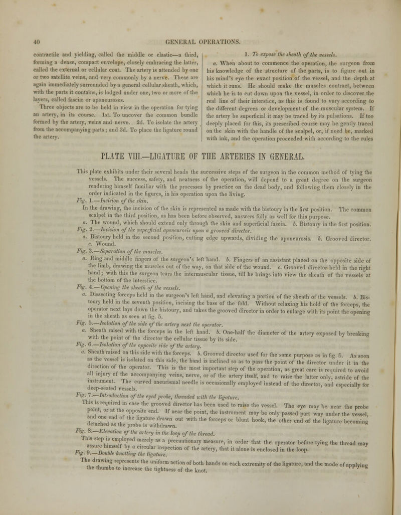 contractile and yielding, called the middle or elastic—a third, forming B dense, compact envelope, closely embracing the latter, called the external or cellular coat. The artery is attended by one or two satellite veins, and very commonly by a nerve. These are nLrain immediately surrounded by a general cellular sheath, which, with the parts it contains, is lodged under one, two or more of the Livers, called fascia? or aponeuroses. Three objects are to be held in view in the operation for tying an artery, in its course. 1st. To uncover the common bundle formed by the artery, veins and nerve. 2d. To isolate the artery from the accompanying parts ; and 3d. To place the ligature round the artery. 1. To expose the sheath of the vessels, a. When about to commence the operation, the surgeon from his knowledge of the structure of the parts, is to figure out in his mind's eye the exact position of the vessel, and the depth at which it runs. He should make the muscles contract, between which he is to cut down upon the vessel, in order to discover the real line of their interstice, as this is found to vary according to the different degrees or development of the muscular system. If the artery be superficial it may be traced by its pulsations. If too deeply placed for this, its prescribed course may be gently traced on the skin with the handle of the scalpel, or, if need be, marked with ink, and the operation proceeded with according to the rules PLATE VHL—LIGATURE OF THE ARTERIES IN GENERAL. This plate exhibits under their several heads the successive steps of the surgeon in the common method of tying the vessels. The success, safety, and neatness of the operation, will depend to a great degree on the surgeon rendering himself familiar with the processes by practice on the dead body, and following them closely in the order indicated in the figures, in his operation upon the living. Fig. 1.—Incision of the skin. In the drawing, the incision of the skin is represented as made with the bistoury in the first position. The common scalpel in the third position, as has been before observed, answers fully as well for this purpose. a. The wound, which should extend only through the skin and superficial fascia, b. Bistoury in the first position. Fig. 2.—Incision of the superficial aponeurosis upon a grooved director. a. Bistoury held in the second position, cutting edge upwards, dividing the aponeurosis, h. Grooved director, c. Wound. Fig. 3.—Separation of the muscles. a. Ring and middle fingers of the surgeon's left hand. h. Fingers of an assistant placed on the opposite side of the limb, drawing the muscles out of the way, on that side of the wound, c. Grooved director held in the right hand ; with this the surgeon tears the intermuscular tissue, till he brings into view the sheath of the vessels at the bottom of the interstice. Fig. 4.— Opening the sheath of the vessels. a. Dissecting forceps held in the surgeon's left hand, and elevating a portion of the sheath of the vessels, b. Bis- toury held in the seventh position, incising the base of the fold. Without relaxing his hold of the forceps, the operator next lays down the bistoury, and takes the grooved director in order to enlarge with its point the opening in the sheath as seen at fig. 5. Fig. 5.—Isolation of the side of the artery next the operator. a. Sheath raised with the forceps in the left hand. b. One-half the diameter of the artery exposed by breaking with the point of the director the cellular tissue by its side. Fig. 6.—Isolation of the opposite side of the artery. a. Sheath raised on this side with the forceps, b. Grooved director used for the same purpose as in fig. 5. As soon as the vessel is isolated on this side, the hand is inclined so as to pass the point of the director under it in the direction of the operator. This is the most important step of the operation, as great care is required to avoid all injury of the accompanying veins, nerve, or of the artery itself, and to raise the latter only, astride of the instrument. The curved aneurismal needle is occasionally employed instead of the director, and especially for deep-seated vessels. J Fig. 7.—Introduction of the eyed probe, threaded with the ligature. This is required in case the grooved director has been used to raise the vessel. The eye may be near the probe point, or at the opposite end. If near the point, the instrument may be only passed part way under the vessel, A* TT 1 ^gatUre draWn °Ut With the f01'CePS °r blunt hook' the other e*d of the ligature becoming detached as the probe is withdrawn. fc Fig. 8.—Elevation of the artery in the loop of the thread. This step is employed merely as a precautionary measure, in order that the operator before tying the thread may assure himself by a circular inspection of the artery, that it alone is enclosed in the loop. rig. y.—Double knotting the ligature. The drawing represents the uniform action of both hands on each extremity of the ligature, and the mode of applying the thumbs to increase the tightness of the knot. g