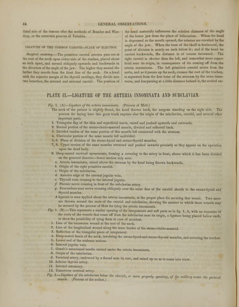 distal side of the tumour after the methods of Brasdor and War- drop, or the uncertain process of Valsalva. LIGATURE OF THE COMMON CAROTID—PLACE OF ELECTION. Surtrical anatomy.—The primitive carotid arteries pass out at the root of the neck upon either side of the trachea, placed about an inch apart, and ascend obliquely upwards and backwards in the direction of the angle of the jaw. The higher they ascend the farther they recede from the front line of the neck. On a level with the superior margin of the thyroid cartilage, they divide into two branches, the internal and external carotid. The position of the head materially influences the relative distance of the angle of the lower jaw from the place of bifurcation. When the head is depressed or the mouth opened, the arteries are covered by the angle of the jaw. When the base of the skull is horizontal, the point of division is nearly an inch below it; and if the head be carried backwards, the distance is of course increased. The right carotid is shorter than the left, and somewhat more super- ficial near its origin, in consequence of its coming off' from the arteria innorainata. The left primitive carotid arises from the aorta, and as it passes up the neck, crosses the root of the trachea, is separated from the first bone of the sternum by the vena trans- versa, and has passing at a little distance behind it, the arched ex- PLATE II.—LIGATURE OF THE ARTERIA INNOMINATA AND SUBCLAVIAN. Fig. 1. (A)—Ligature of the arteria innominata. (Process of Mott.) The neck of the patient is slightly flexed, the head thrown back, the surgeon standing on the right side. The process for laying bare this great trunk exposes also the origin of the subclavian, carotid, and several other important parts. 1. Triangular flap of the skin and superficial fascia, raised and pushed upwards and outwards. 2. Sternal portion of the sterno-cleido-mastoid muscle, divided and reflected back. 3. Divided tendon of the same portion of this muscle left connected with the sternum. 4. Clavicular portion of the same muscle left undivided. 5. 6. Place of division of the sterno-hyoid and sterno-thyroid muscles. 7, 8. Upper section of the same muscles retracted and pushed inwards precisely as they appear on the operation upon the dead body. 9. Deep-seated cervical aponeurosis, forming a covering to the artery in front, above which it has been divided on the grooved director—lower section only seen. a. Arteria innominata, raised above the sternum by the head being thrown backwards. b. Origin of the right primitive carotid. c. Origin of the subclavian. d. Anterior edge of the internal jugular vein. e. Thyroid vein crossing to the internal jugular. f. Phrenic nerve crossing in front of the subclavian artery. g. Descendens noni nerve crossing obliquely over the outer face of the carotid sheath to the sterno-hyoid and thyroid muscles. A ligature is seen applied about the arteria innominata, at the proper place for securing that vessel. Two more are thrown around the roots of the carotid and subclavian, showing the manner in which these vessels may be secured by the process of Mott for tying the arteria innominata. Fig. 1. (B).—This represents a similar opening of the integuments and soft parts as in fig. 1, A, with an exposure of the roots of the vessels that come off from the subclavian near its origin, a ligature being placed below each, to show the possibility of tying them in case of accident. 1. Line of the transverse wound at the root of the neck. 2. Line of the longitudinal wound along the inner border of the sterno-cleido-mastoid. 3. Reflection of the triangular piece of integument. 4. Deep-seated fascia of the neck, involving the sterno-hyoid and sterno-thyroid muscle 5. Lower end of the scalenus anticus. 6. Internal jugular vein. 7. Graefe's aneurismal needle carried under the arteria innominata. .8. Origin of the subclavian. 9. Vertebral artery, embraced by a thread near its root, and raised up so as to come into 10. Inferior thyroid artery. 11. Internal mammary. 12. Transverse cervical artery. les, and covering the trachea. Fig. 2.—Ligature of the subclavian below the clavicle muscle. (Process of the author.) , or more properly speaking, of the axillary under the pectoral