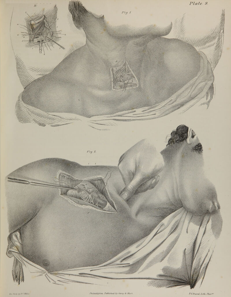 N\\ Fig. 1 J ■■k %*- «« ^-,., /•/ y V r 1 # . ,. .-... .. ^. ■■■■:,->■■■ .^..-i '-ftfgSSl rhiUt(Ulphi-a. PiMUIiecCby (arey fr Jfart-. PS Duval. Litii r/u/<