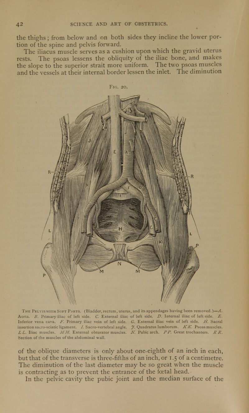 the thighs; from below and on both sides they incline the lower por- tion of the spine and pelvis forward. The iliacus muscle serves as a cushion upon which the gravid uterus rests. The psoas lessens the obliquity of the iliac bone, and makes the slope to the superior strait more uniform. The two psoas muscles and the vessels at their internal border lessen the inlet. The diminution Fig. 20. The Pelvis with Soft Parts. (Bladder, rectum, uterus, and its appendages having been removed.)—A. Aorta. B. Primary iliac of left side. C. External iliac of left side. D. Internal iliac of left side. E. Inferior vena cava. F. Primary iliac vein of left side. G. External iliac vein of left side. //. Sacral insertion sacro-sciatic ligament. /. Sacro-vertebral angle, y. Quadratus lumborum. KK. Psoas muscles. LL. Iliac muscles. MM. External obturator muscles. N. Pubic arch. PP. Great trochanters. R R. Section of the muscles of the abdominal wall. of the oblique diameters is only about one-eighth of an inch in each, but that of the transverse is three-fifths of an inch, or 1.5 of a centimetre. The diminution of the last diameter may be so great when the muscle is contracting as to prevent the entrance of the foetal head. In the pelvic cavity the pubic joint and the median surface of the