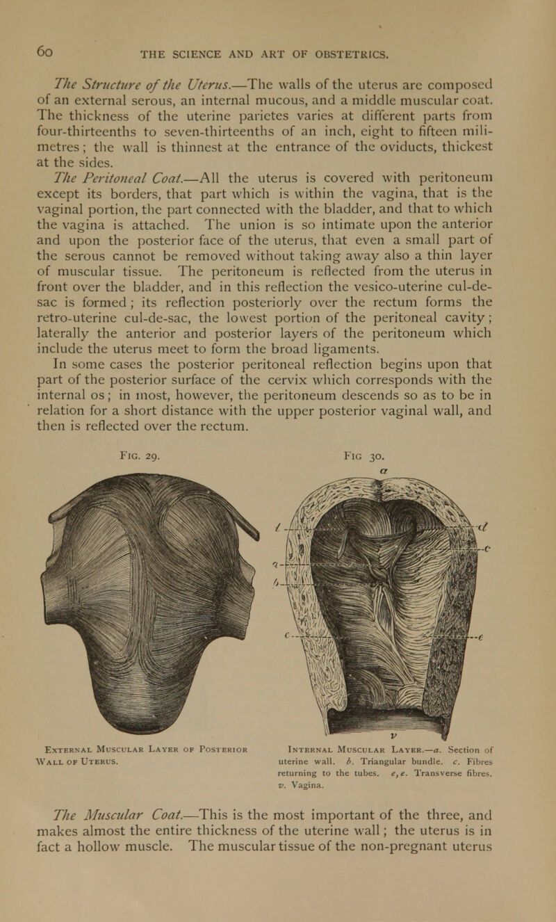 The Structure of the Uterus.—The walls of the uterus arc composed of an external serous, an internal mucous, and a middle muscular coat. The thickness of the uterine parietes varies at different parts from four-thirteenths to seven-thirteenths of an inch, eight to fifteen mili- metres; the wall is thinnest at the entrance of the oviducts, thickest at the sides. The Peritoneal Coat.—All the uterus is covered with peritoneum except its borders, that part which is within the vagina, that is the vaginal portion, the part connected with the bladder, and that to which the vagina is attached. The union is so intimate upon the anterior and upon the posterior face of the uterus, that even a small part of the serous cannot be removed without taking away also a thin layer of muscular tissue. The peritoneum is reflected from the uterus in front over the bladder, and in this reflection the vesico-uterine cul-de- sac is formed ; its reflection posteriorly over the rectum forms the retro-uterine cul-de-sac, the lowest portion of the peritoneal cavity ; laterally the anterior and posterior layers of the peritoneum which include the uterus meet to form the broad ligaments. In some cases the posterior peritoneal reflection begins upon that part of the posterior surface of the cervix which corresponds with the internal os; in most, however, the peritoneum descends so as to be in relation for a short distance with the upper posterior vaginal wall, and then is reflected over the rectum. The Muscular Coat.—This is the most important of the three, and makes almost the entire thickness of the uterine wall; the uterus is in fact a hollow muscle. The muscular tissue of the non-pregnant uterus