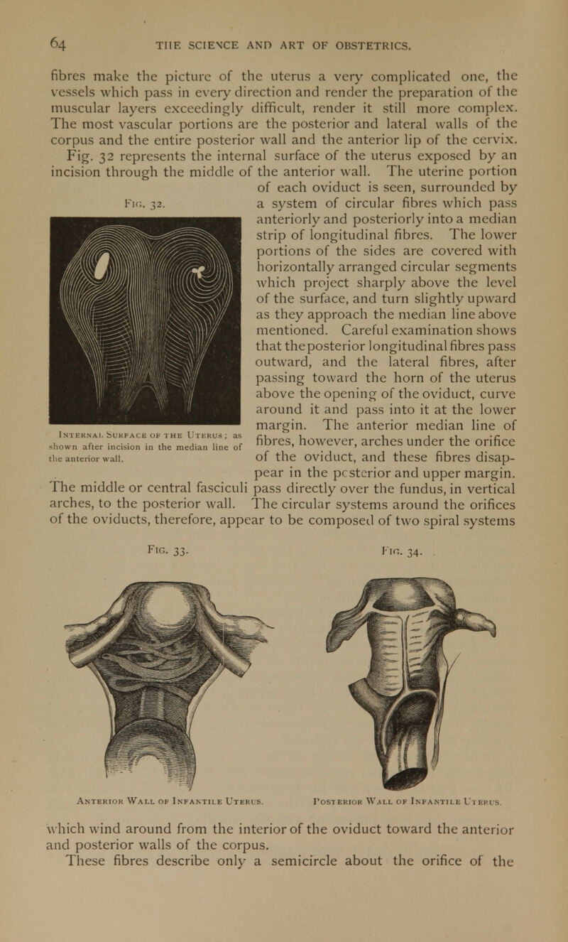 fibres make the picture of the uterus a very complicated one, the vessels which pass in every direction and render the preparation of the muscular layers exceedingly difficult, render it still more complex. The most vascular portions are the posterior and lateral walls of the corpus and the entire posterior wall and the anterior lip of the cervix. Fig. 32 represents the internal surface of the uterus exposed by an incision through the middle of the anterior wall. The uterine portion of each oviduct is seen, surrounded by a system of circular fibres which pass anteriorly and posteriorly into a median strip of longitudinal fibres. The lower portions of the sides are covered with horizontally arranged circular segments which project sharply above the level of the surface, and turn slightly upward as they approach the median line above mentioned. Careful examination shows that theposterior longitudinal fibres pass outward, and the lateral fibres, after passing toward the horn of the uterus above the opening of the oviduct, curve around it and pass into it at the lower margin. The anterior median line of fibres, however, arches under the orifice of the oviduct, and these fibres disap- pear in the posterior and upper margin. The middle or central fasciculi pass directly over the fundus, in vertical arches, to the posterior wall. The circular systems around the orifices of the oviducts, therefore, appear to be composed of two spiral systems Internal Surface of the Uterus; as shown after incision in the median line of the anterior wall. Fig. Fig. 34. Anterior Wall of Infantile Uterus. Posterior Wall of Infantile Uteris. w hich wind around from the interior of the oviduct toward the anterior and posterior walls of the corpus. These fibres describe only a semicircle about the orifice of the