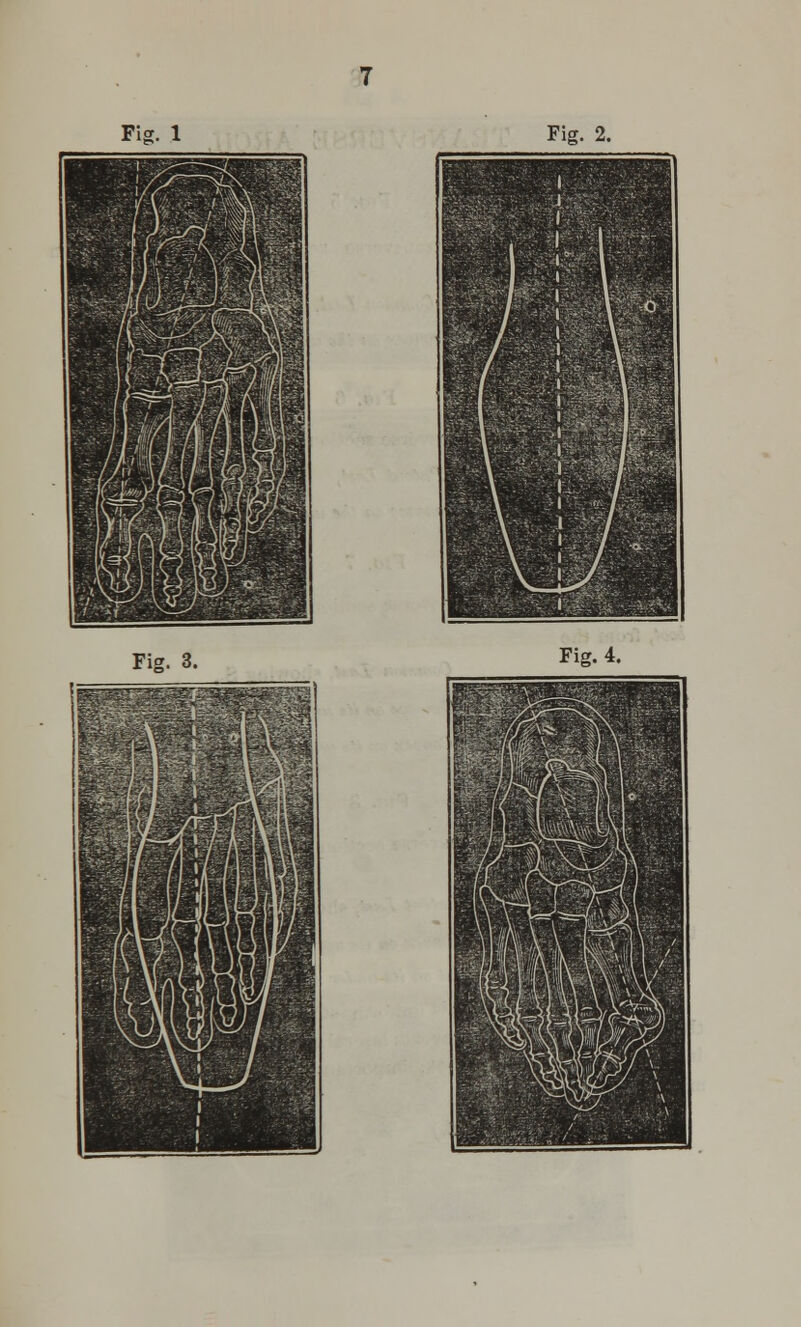 Fig. 3. Fig. 4.