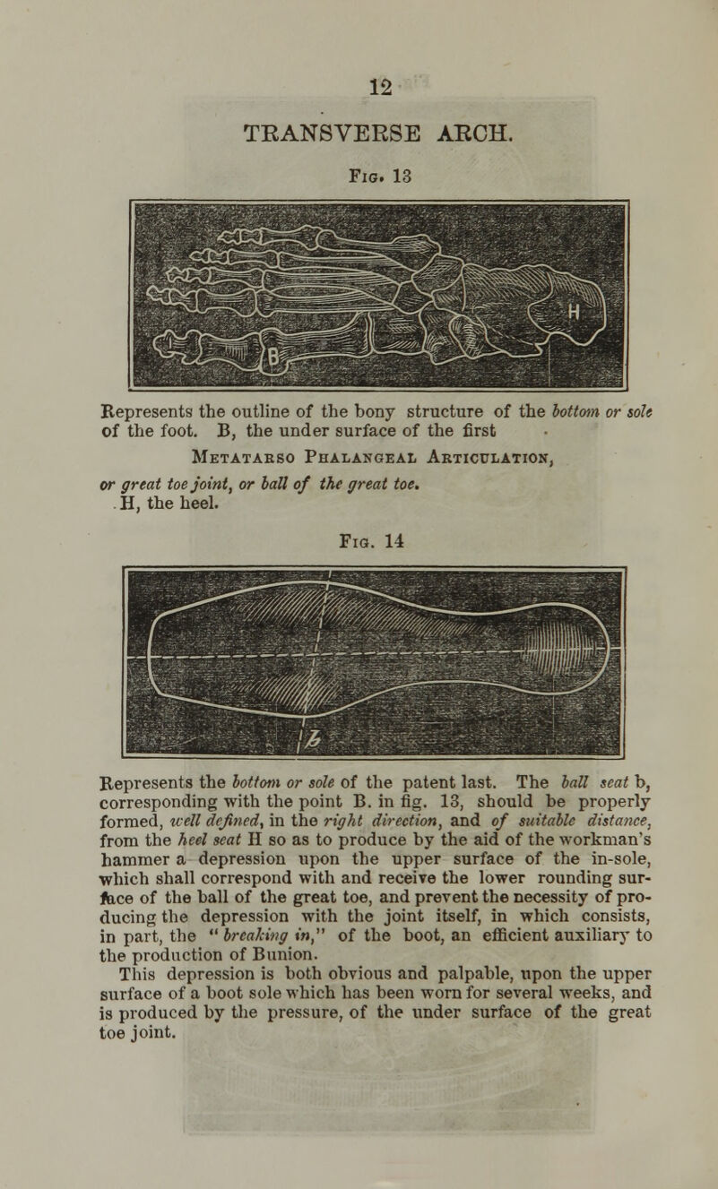 TRANSVERSE ARCH. Fig. 13 Represents the outline of the bony structure of the bottom or sole of the foot. B, the under surface of the first Metataeso Phalangeal Articulation, or great toe joint, or ball of the great toe. . H, the heel. Fig. 14 Represents the bottom or sole of the patent last. The ball scat b, corresponding with the point B. in fig. 13, should be properly formed, icell defined, in the right direction, and of suitable distance, from the heel seat H so as to produce by the aid of the workman's hammer a depression upon the upper surface of the in-sole, which shall correspond with and receive the lower rounding sur- face of the ball of the great toe, and prevent the necessity of pro- ducing the depression with the joint itself, in which consists, in part, the  breaking in, of the boot, an efficient auxiliary to the production of Bunion. This depression is both obvious and palpable, upon the upper surface of a boot sole which has been worn for several weeks, and is produced by the pressure, of the under surface of the great toe joint.