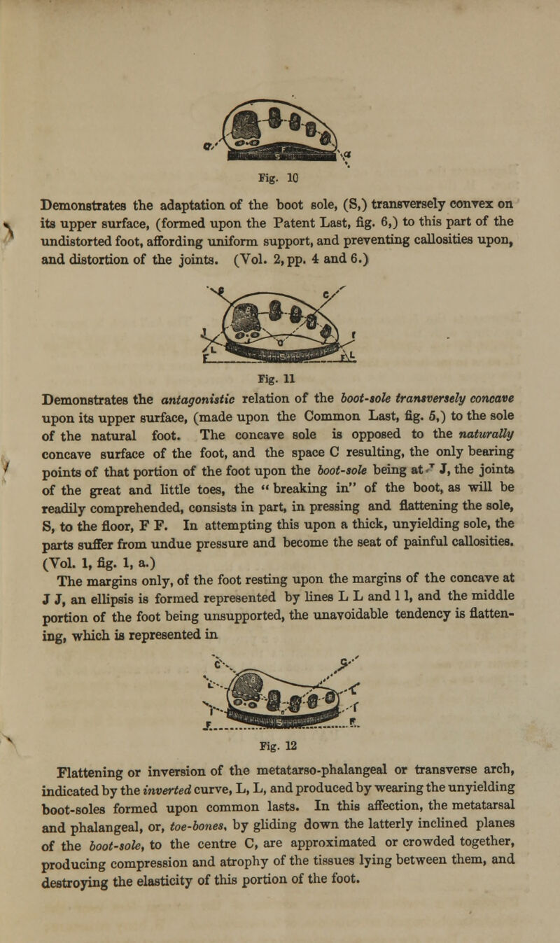 Fig. 10 Demonstrates the adaptation of the hoot sole, (S,) transversely convex on its upper surface, (formed upon the Patent Last, fig. 6,) to this part of the undistorted foot, affording imiform support, and preventing callosities upon, and distortion of the joints. (Vol. 2, pp. 4 and 6.) rig. 11 Demonstrates the antagonistic relation of the boot-sole transversely concave upon its upper surface, (made upon the Common Last, fig. 5,) to the sole of the natural foot. The concave sole is opposed to the naturally concave surface of the foot, and the space C resulting, the only bearing points of that portion of the foot upon the boot-sole being at -^ J, the joints of the great and Uttle toes, the  breaking in of the boot, as will be readily comprehended, consists in part, in pressing and flattening the sole, S, to the floor, F F. In attempting this upon a thick, unyielding sole, the parts sxifier from undue pressure and become the seat of painful callosities. (Vol. 1, fig. 1, a.) The margins only, of the foot resting upon the margins of the concave at J J, an ellipsis is formed represented by Hues L L and 11, and the middle portion of the foot being unsupported, the unavoidable tendency is flatten- ing, which is represented in Fig. 12 Flattening or inversion of the metatarso-phalangeal or transverse arch, indicated by the inverted curve, L, L, and produced by wearing the unyielding boot-soles formed upon common lasts. In this affection, the metatarsal and phalangeal, or, toe-bones, by gUding down the latterly incUned planes of the boot-sole, to the centre C, are approximated or crowded together, producing compression and atrophy of the tissues lying between them, and destroying the elasticity of this portion of the foot.