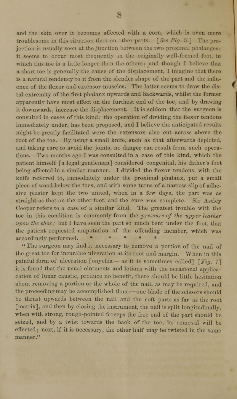 and the skin over it becomes affectecl -with a corn, -which is even more troublesome in tliis situation than on other parts. [See Fig. 3.] The pro- jection is usually seen at the junction between the two proximal plialangcs; it seems to occur most frequently in the originally well-formed foot, in which this toe is a little longer than the others ; ^and though I believe that a short toe is generally the cause of the displacement, I imagine that there is a natural tendency to it from the slender shape of the part and the influ- ence of the flexor and extensor muscles. The latter seems to draw the dis- tal extremity of the first phalanx upAvards and backwards, wliilst the former apparently have most eflfect on the furthest end of the toe, and by drawing it downwards, increase the displacement. It is seldom that the surgeon is consulted in cases of tliis kind; the operation of dividing the flexor tendons immediately under, has been proposed, and I believe the anticipated results might be greatly facilitated were the extensors also cut across above the root of the toe. By using a small knife, such as that afterwards depicted, and taking care to avoid the joints, no danger can result from such opera- tions. Two months ago I was consulted in a case of this kind, which the patient himself [a legal gentleman] considered congenital, his father's foot being affected in a similar manner. I divided the flexor tendons, with the knife referred to, immediately under the proximal phalanx, put a small piece of wood below the toes, and with some turns of a narrow slip of adhe- sive plaster kept the two united, when in a few days, the part was as straight as that on the other foot, and the cure was complete. Sir Astley Cooper refers to a case of a similar kind. The greatest trouble with the toe in this condition is commonly from the pressure of the upper leather upon the shoe; but I have seen the part so much bent under the foot, that the patient requested amputation of the offending member, which was accordingly performed. * * # * *  The surgeon may find it necessary to remove a portion of the nail of the great toe for incurable ulceration at its root and margin. When in this painful form of ulceration [onychia—as it is sometimes called] [Fig. 7] it is found that the usual ointments and lotions with the occasional applica- cation of lunar caustic, produce no benefit, there should be little hesitation about removing a portion or the wliolc of the nail, as may be required, and the proceeding may be accomplished thus :—one blade of the scissors should be thrust upwards between the nail and the soft parts as far as the root [matrix], and then by closing the instrument, the nail is split longitudinally, when with strong, rough-pointed forceps the free end of the part should be seized, and by a twist towards the back of the toe, its removal Avill be effected; next, if it is necessary, the other half may be twisted in the same manner.