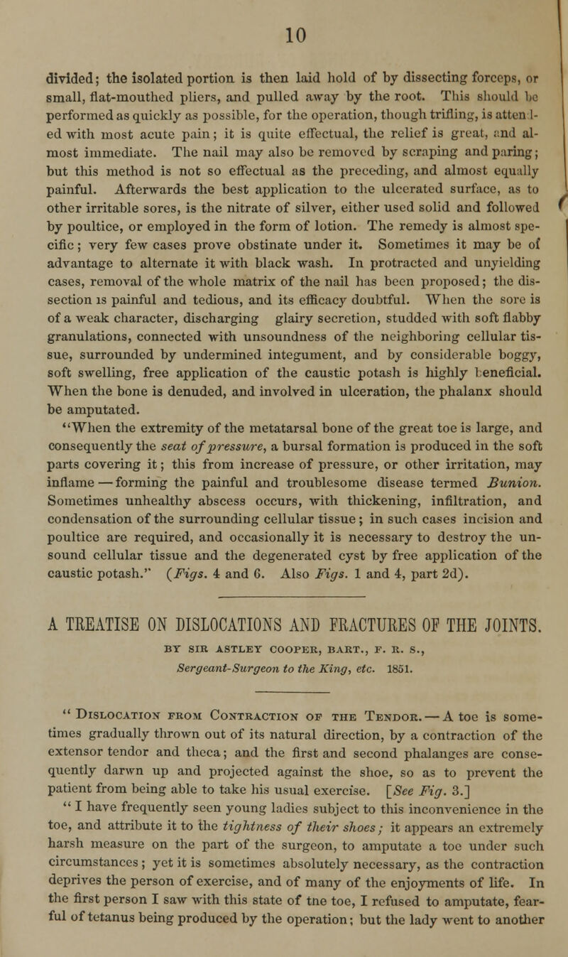 divided; the isolated portion is then laid hold of hy dissecting forceps, or small, flat-mouthed pliers, and pulled away by the root. This should Lc performed as quickly as possible, for the operation, though trifling, is atten 1- ed with most acute pain; it is quite effectual, the relief is great, and al- most immediate. The nail may also be removed by scraping and paring; but this method is not so effectual as the preceding, and almost equally painful. Afterwards the best application to the ulcerated surface, as to other irritable sores, is the nitrate of silver, either used solid and followed by poultice, or employed in the form of lotion. The remedy is almost spe- cific ; very few cases prove obstinate under it. Sometimes it may be of advantage to alternate it with black wash. In protracted and unyielding cases, removal of the whole matrix of the nail has been proposed; the dis- section is painful and tedious, and its efficacy doubtful. When the sore is of a weak character, discharging glairy secretion, studded with soft flabby granulations, connected with unsoundness of the neighboring cellular tis- sue, surrounded by undermined integument, and by considerable boggy, soft swelling, free application of the caustic potash is highly leneficial. When the bone is denuded, and involved in ulceration, the phalanx should be amputated. When the extremity of the metatarsal bone of the great toe is large, and consequently the seat of pressure, a bursal formation is produced in the soft parts covering it; this from increase of pressure, or other irritation, may inflame — forming the painful and troublesome disease termed Bunion. Sometimes unhealthy abscess occurs, with thickening, infiltration, and condensation of the surrounding cellular tissue; in such cases incision and poultice are required, and occasionally it is necessary to destroy the un- sound cellular tissue and the degenerated cyst by free application of the caustic potash.' (Figs. 4 and C. Also Figs. 1 and 4, part 2d). A TREATISE ON DISLOCATIONS AND FRACTURES OF THE JOINTS. BY SIR ASTLEY COOPKK, BART., F. R. S., Sergeant-Surgeon to the King, etc. 1851. Dislocation from Contraction of the Tendor. — A toe is some- times gradually thrown out of its natural direction, by a contraction of the extensor tendor and theca; and the first and second phalanges are conse- quently darwn up and projected against the shoe, so as to prevent the patient from being able to take his usual exercise. [See Fig. 3.]  I have frequently seen young ladies subject to this inconvenience in the toe, and attribute it to the tightness of their shoes; it appears an extremely harsh measure on the part of the surgeon, to amputate a toe under such circumstances; yet it is sometimes absolutely necessary, as the contraction deprives the person of exercise, and of many of the enjoyments of life. In the first person I saw with this state of tne toe, I refused to amputate, fear- ful of tetanus bemg produced by the operation; but the lady went to another