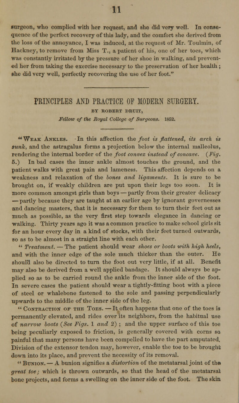 surgeon, who complied with her request, and she did very well. In conse- quence of the perfect recovery of this lady, and the comfort she derived from the loss of the annoyance, I was induced, at the request of Mr. Toulmin, of Hackney, to remove from Miss T., a patient of his, one of her toes, which was constantly irritated by the pressure of her shoe in walking, and prevent- ed her from taking the exercise necessary to the preservation of her health ; she did very well, perfectly recovering the use of her foot. PRINCIPLES AND PRACTICE OF MODERN SURGERY. BY ROBERT DRUIT, JFellow of the Royal College of Surgeons. 1852. ** Weak Ankles. • In this affection the foot is flattened, its arch is sunk, and the astragalus forms a projection below the internal malleolus, rendering the internal border of the foot convex instead of concave. {Fig. 6.) In bad cases the inner ankle almost touches the ground, and the patient walks with great pain and lameness. This affection depends on a weakness and relaxation of the hones and ligaments. It is sure to be brought on, if weakly children are put upon their legs too soon. It is more common amongst girls than boys — partly from their greater delicacy — partly because they are taught at an earlier age by ignorant governesses and dancing masters, that it is necessary for them to turn their feet out as much as possible, as the very first step towards elegance in dancing or walking. Thirty years ago it was a common practice to make school girls sit for an hour every day in a kind of stocks, with their feet turned outwards, so as to be almost in a straight line with each other.  Treatment. — The patient should wear shoes or boots with high heels, and with the inner edge of the sole much thicker than the outer. He should also be directed to turn the foot out very little, if at all. Benefit may also be derived from a well applied bandage. It should always be ap- plied so as to be carried round the ankle from the inner side of the foot. In severe cases the patient should wear a tightly-fitting boot with a piece of steel or whalebone fastened to the sole and passing perpendicularly upwards to the middle of the inner side of the leg. *' Contraction of the Toes. —It often happens that one of the toes is permanently elevated, and rides over its neighbors, from the habitual use of narrow hoots (See Figs. 1 and 2) ; and the upper surface of this toe being peculiarly exposed to friction, is generally covered with corns so painful that many persons have been compelled to have the part amputated. Division of the extensor tendon may, however, enable the toe to be brought down into its place, and prevent the necessity of its removal.  Bunion. — A bunion signifies a distortion of the metatarsal joint of the great toe; which is thrown outwards, so that the head of the metatarsal bone projects, and forms a swelling on the inner side of the foot. The skin