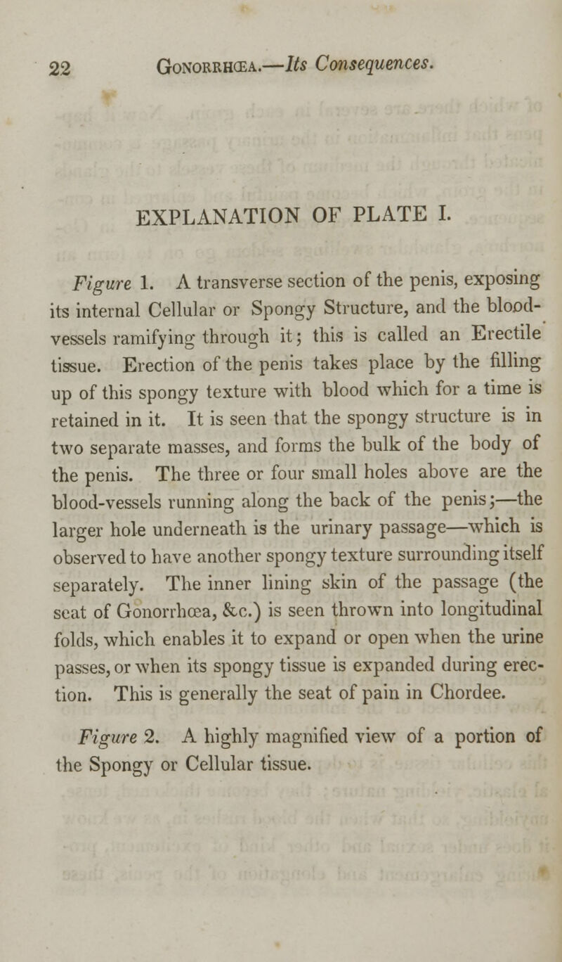 EXPLANATION OF PLATE I. Figure 1. A transverse section of the penis, exposing its internal Cellular or Spongy Structure, and the blood- vessels ramifying through it; this is called an Erectile tissue. Erection of the penis takes place by the filling up of this spongy texture with blood which for a time is retained in it. It is seen that the spongy structure is in two separate masses, and forms the bulk of the body of the penis. The three or four small holes above are the blood-vessels running along the back of the penis;—the larger hole underneath is the urinary passage—which is observed to have another spongy texture surrounding itself separately. The inner lining skin of the passage (the seat of Gonorrhoea, &c.) is seen thrown into longitudinal folds, which enables it to expand or open when the urine passes, or when its spongy tissue is expanded during erec- tion. This is generally the seat of pain in Chordee. Figure 2. A highly magnified view of a portion of the Spongy or Cellular tissue.