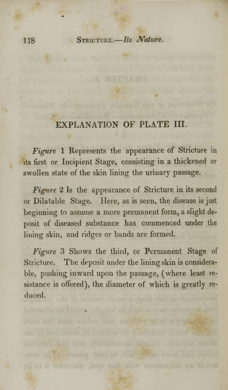 EXPLANATION OF PLATE III. Figure 1 Represents the appearance of Stricture in its first or Incipient Stage, consisting in a thickened or swollen state of the skin lining the urinary passage. Figure 2 Is the appearance of Stricture in its second or Dilatable Stage. Here, as is seen, the disease is just beginning to assume a more permanent form, a slight de- posit of diseased substance has commenced under the lining skin, and ridges or bands are formed. Figure 3 Shows the third, or Permanent Stage of Stricture. The deposit under the lining skin is considera- ble, pushing inward upon the passage, (where least re- sistance is offered), the diameter of which is greatly re- duced.