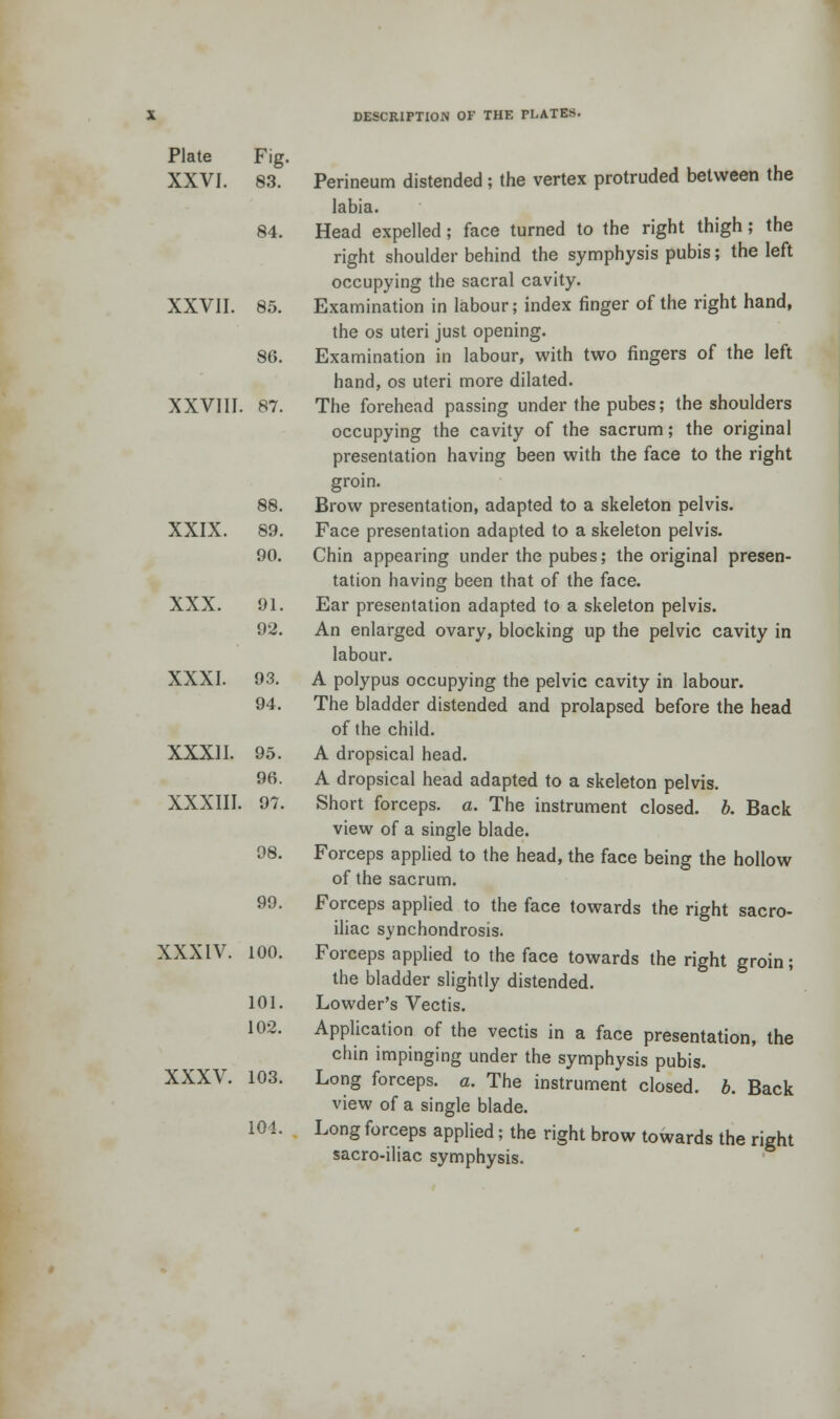 Plate Fig. XXVI. 83. 84. XXVII. 85. 86. XXVIII. 87. 88. XXIX. 89. 90. XXX. 91. 92. XXXI. 93. 94. XXXII. 95. 96. XXXIII 97. 98. 99. XXXIV. 100. 101. 102. XXXV. 103. 104. Perineum distended; the vertex protruded between the labia. Head expelled; face turned to the right thigh; the right shoulder behind the symphysis pubis; the left occupying the sacral cavity. Examination in labour; index finger of the right hand, the os uteri just opening. Examination in labour, with two fingers of the left hand, os uteri more dilated. The forehead passing under the pubes; the shoulders occupying the cavity of the sacrum; the original presentation having been with the face to the right groin. Brow presentation, adapted to a skeleton pelvis. Face presentation adapted to a skeleton pelvis. Chin appearing under the pubes; the original presen- tation having been that of the face. Ear presentation adapted to a skeleton pelvis. An enlarged ovary, blocking up the pelvic cavity in labour. A polypus occupying the pelvic cavity in labour. The bladder distended and prolapsed before the head of the child. A dropsical head. A dropsical head adapted to a skeleton pelvis. Short forceps, a. The instrument closed, b. Back view of a single blade. Forceps applied to the head, the face being the hollow of the sacrum. Forceps applied to the face towards the right sacro- iliac synchondrosis. Forceps applied to the face towards the right groin; the bladder slightly distended. Lowder's Vectis. Application of the vectis in a face presentation, the chin impinging under the symphysis pubis. Long forceps, a. The instrument closed, b. Back view of a single blade. Long forceps applied; the right brow towards the right sacro-iliac symphysis.