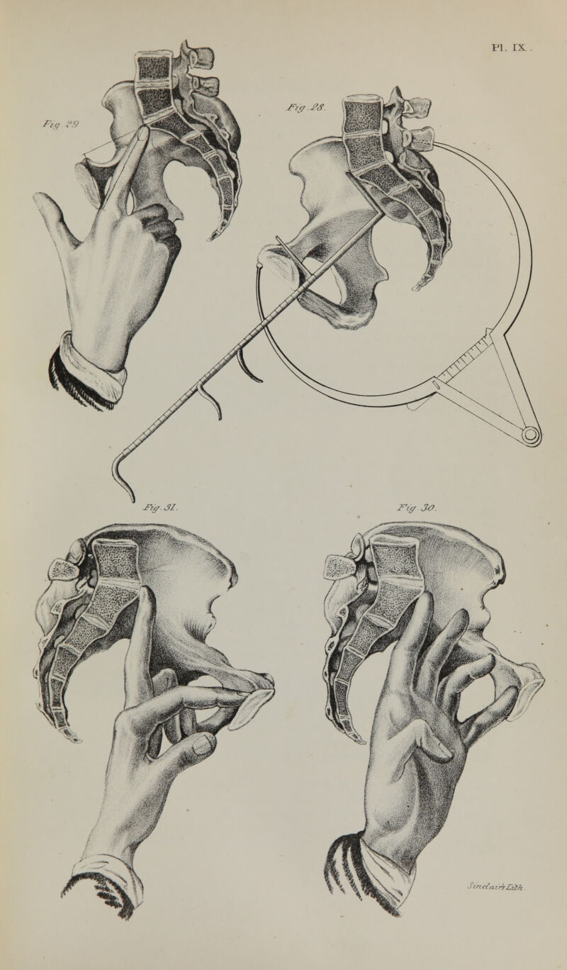 Pig .' Sini^aJr-rSri/r
