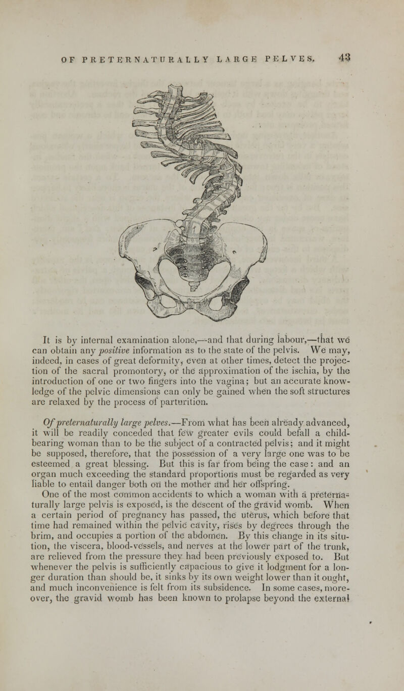 It is by internal examination alone,—^-and that during labour,—that we can obtain any positive information as to the state of the pelvis. We may, indeed, in cases of great deformity ^ even at other times, detect the projec- tion of the sacral promontory, or the approximation of the ischia, by the introduction of one or two fingers into the vagina; but an accurate know- ledge of the pelvic dimensions can only be gained when the soft structures arc relaxed by the process of parturition. Of preter naturally large pelves.—From what has been already advanced, it will be readily conceded that few greater evils could befall a child- bearing woman than to be the subject of a contracted pelvis; and it might be supposed, therefore, that the possession of a very large one was to be esteemed a great blessing. But this is far from being the case: and an organ much exceeding the standard proportions must be regarded as very liable to entail danger both on the mother and her offspring. One of the most common accidents to which a woman with a preterna- turally large pelvis is exposed, is the descent of the gravid womb. When a certain period of pregnancy has passed, the uterus, which before that time had remained within the pelvic cavity, rises by degrees through the brim, and occupies a portion of the abdomen. By this change in its situ- tion, the viscera, blood-vessels, and nerves at the lower part of the trunk, are relieved from the pressure they had been previously exposed to. But whenever the pelvis is sufficiently capacious to give it lodgment for a lon- ger duration than should be, it sinks by its own weight lower than it ought, and much inconvenience is felt from its subsidence. In some cases, more- over, the gravid womb has been known to prolapse beyond the external