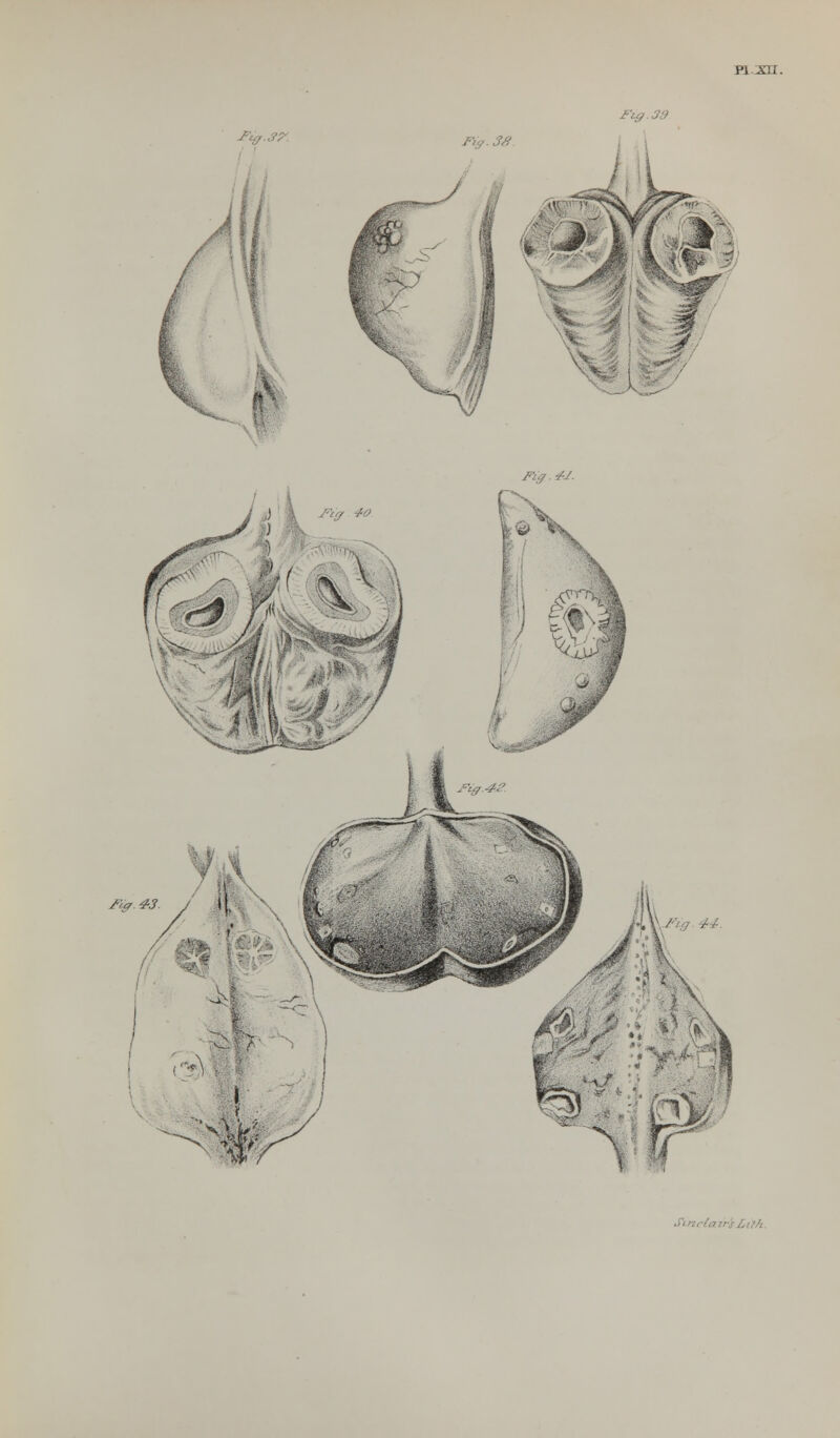 Fig. 39 F^.S?. JRg.*J. ) Figr SO ) 0&%: n v 'r-'s£ifh.