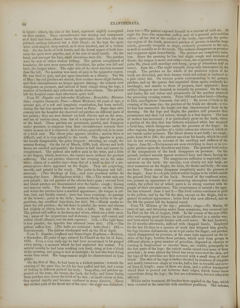 M | the hand, appeared slightly com on thei ferencewas shining and transparent : under the epidermis; but when this was wed but a little blood; on the legs the spots . as it w.re knotted, and of a violeni tint, I if both hands, and the dorsal aspect of both fore- papular, and of the size of small lentils. On the e hair, small elevations were felt The patches rather violent itching. The patient complained of eyes m re somewhat bloodshot, the pulse was full and hard, : white. The right side of the chi St was less resonant than t! V. mention was made of pain in the epigastric region. - bled to = \ii, and put upon lemonade as a diluent. The 8th patches are shrunk, their surface shows slight furfura?, and their circumference no longer appears shining; the redness now disappears on pressure, and instead of hard risings along the legs, a number of brownish and yellowish marks alone remain. The patient left the hospital some days afterwards quite well. i l\. Papular anil tubercular Erythema; Bronchitis; Rheuma- i■/ uii'irc rheumatic Fever.—Marie Michaud, 22 years of age, a ::i i^irl, of a soft and lymphatic constitution, has been unwell, during the last four months she has lived in Paris. Some days after coming into the hospital she observed red patches on different parts of her person ; they are now distinct on both elbows and on the arms, and are of various sizes, from that of a sixpence to that of the palm of the hand. These patches are prominent, painful, and disappear under pressure, to reappear from their circumference towards their centre as soon as it is removed ; their colour, generally red, is in some of a livid cast. The elbow joint appears swollen; motion there is difficult, and it is very painful to the touch. The appetite is gone, the breath disagreeable, the pulse frequent ; sweating, no cough, the menses flowing. On the 1st of March, 1830, both elbows and both knees are swelled and painful; the former is half bent and cannot be straightened. The patient also suffers pain in the wTrist, and a little in the lingers, which, however, she cannot move without the greatest suffering. The red patches observed last evening are in the same stale ; others of a smaller size—from that of a lentil to that of a six- pennv-piere—have appeared on the thighs. They are projecting, smooth, and painful to the touch. The pulse is frequent and full ; anorexia. (Two bleedings of oxii., each were practiced within the twenty-four hours. Mucilaginous drink.) 6th.—The wrists only are now painful ; the red patches of the elbows have gone ; several livid and bluish patches are disseminated over the limbs : cough ; hissing and mucous rattle. The rheumatic pains continue ; on the elbows and wrists the patches have a marbled appearance; the tongue is yel- low, foul, ami thickly coated ; there has been vomiting; no passage of the bowels ; pains in the belly; insomnia (thirty leeches to (he epi- gastrium, tiro emollient injections, low diet). 8th.—Bluish marks re- place the red patches; the left knee is painful, the wrists and elbows but slightly so (thirty leeches to the knee, a bath). 9th and 10th.— The patient still suffers in the knees and wrists, which are a little swol- len ; pains of the epigastrium and abdomen ; tongue still coated and yellow (broth allowed, and the bath repeated). 11th.—The right knee is leas painful; the appetite has returned (same diet). 17th.—The patient sutlers less. [The baths are continued; better food.) 22d.— Convalescent. The patient discharged well on the 3d of April. C IBS V. Papular, confluent and hemorrhagic Erythema.—Bridoux, a shoemaker, 23 years of age, entered La Charite on the 1st of June, L831. From a very early age he had been accustomed to be purged every spring; a measure which he had neglected this season. For 1 months he had been working very hard, rising at four o'clock in the morning, and going to bed at midnight; he had also been living than usual. His temperament might be characterized as lym- phatic. On the 31st of May, he had been in a violent passion ; towards the the same day, he felt his face puffed and hot, and a sense bing in different parts of his body. Soon after, red patches ap- 1 on the arms, the breast, die back, the belly, and lower limbs; : catches rose above the level of the skin ; of small extent at first, :>read rapidly and became confluent in many districts. There leither pain oi' the throat nor of the eyes : the night was disturbed. June Is:.—The patient exposed himself to a current of cold air. At night the lice was somewhat puffed, and of a general pale-reddish colour; all the rest of the surface of the body, especially the rior region ^( the trunk, presented patches of greater or smaller mast oitude, generally irregular in shape, evidently prominent to the eye, as well as sensibly so to the touch. The redness disappears on pressure and reappears again immediately. The patches are completely indo- lent. Since the morning he has had slight cough ami soreness of throat; the tongue is moist and rather clean, the respiration is natural, pulse !)(!, (tisan with mucilage and honey, syrup of diacoilium half m ounce). June 2d.—The night tranquil, sleep only interrupted by the cou<di. The patches on the whole of the posterior region of the trunk are shriveled, and their former vivid red colour is replaced by a pale violet tint. On various points corresponding to the primary patches, and on the spaces that separated them, spots, evidently he- morrhagic, and similar to those of purpura, have appeared ; these neither disappear nor diminish in intensity by pressure. On the belly and limbs, the red colour and prominence of the patches observed the preceding evening remain. Pulse 108 and rather hard—[bleeding to Sxii, mucilaginous lemonade, low diet.) By seven o'clock in (he evening of the same day, the patches of the trunk are shrunk; a vio- let hue has succeeded the bright red that characterized them in the morning. On the legs and thighs, the patches still preserve their prominence and their red colour, though in a less degree. The heat of surface has increased ; it is particularly great on the back, where a portion of the skin that has hitherto remained white has acquired a livid hue, which disappears under the pressure of the finger. On other regions, large patches of a violet colour are observed, which do not vanish under pressure. The blood drawn is not buffy ; no cough ; pulse from 86 to 100 ; the patient can close his hands, which he could not do last evening on account of the swelling and stiffness of the fingers. June 3d.—Ecchymoses are seen stretching in lines or in irre- gular patches upon the shoulders and loins. The general livid colour of the integuments of the back disappears on pressure. On this ground, isolated maculae appear scattered here and there, having the colour of ecchymoses. The sanguineous suffusion is especially con- spicuous on the back: the macula?, very closely set and large, are most numerous on the thighs, the loins, the flanks and belly ; the arms are freer. These stains disappear completely under the pressure of the finger. June 4.—A pale yellow colour begins to be visible amidst the general livid hue of the back. Several of the confluent stains, too, present an appearance of commencing absorption towards their centre, the yellow tint of which parts is in strong contrast with the purple of their circumference. The countenance is natural; the appe- tite has returned. June 5 and 6.—The livid colour continues to yield to the yellow, and by the 7th the skin, except on the thighs, had re- gained its natural appearance ; better food was now allowed, and on the 9th the patient left the hospital cured. Case VI. (Edema of the legs; petechia; chaps.—Fr. Martin, 63 years of age, and labouring under these symptoms, was received into La Pitie on the 5th of August, 1826. In the course of the year 1822, after undergoing great fatigue, he had been affected in a similar way, and been cured by simple lotions with cold water. He had, however, for 15 months afterwards, suffered with chapped hands. Employed for the last 14 days in a species of work that fatigued him greatly, his legs became cedematous, so as to pit under the finger; red patches, which disappeared on pressure, at the same time appeared on the in- sides of the legs; besides these patches, which now form groups in different places, a great number of petechia?, disposed in clusters or running in longitudinal or circular lines, are visible, principally on the fore parts of the legs; the cuticle seems raised over some of these petechia? ; in some places the blood has even traversed the skin, and the tops of the petechia? are then covered with a small drop of dried blood. The skin of the legs is farther divided by numbers of irregular and mostly transverse chaps or cracks, half a line in breadth and seve- ral lines in length ; some of these are deep, and a yellow transparent viscid fluid is poured out between their edges, which forms linear concretions along the legs ; the feet are cedematous, but not otherwise affected. Whilst under treatment, 60 leeches were applied to the legs which were covered in the intervals with emollient poultices. The oedema