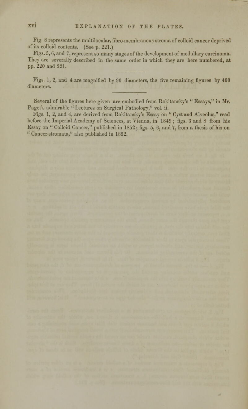 Fig. 8 represents the ni unilocular, fibro-membranous stroma of colloid cancer deprived of its colloid contents. (See p. 221.) Figs. 5, 6, and 7, represent so many stages of the development of medullary carcinoma. They are severally described in the same order in which they are here numbered, at pp. 220 and 221. Figs. 1, 2, and 4 are magnified by 90 diameters, the five remaining figures by 400 diameters. Several of the figures here given are embodied from Rokitansky's  Essays, in Mr. Paget's admirable  Lectures on Surgical Pathology, vol. ii. Figs. 1, 2, and 4, are derived from Rokitansky's Essay on  Cyst and Alveolus, read before the Imperial Academy of Sciences, at Vienna, in 1849 ; figs. 3 and 8 from his Essay on  Colloid Cancer, published in 1852 ; figs. 5, 6, and 7, from a thesis of his on  Cancer-stromata, also published in 1852.
