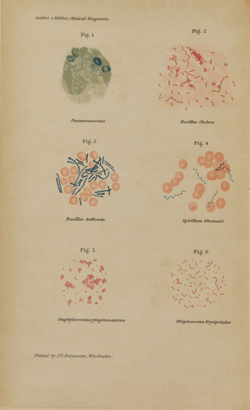 Xfi/rr/ tSMBBer, (Unicoi Diagnosis. Spirillum Obermari rig- 5 Tig. 6  ***** . •. • y . • * •? . -,,- •...... • & : / ■• r? ■* * : . '. .. . ' • Suiphylooccuspyogenesaureus MrplococaisTrysipelatoe Printed brJflBerr/>na/rn , Wiesbaden .