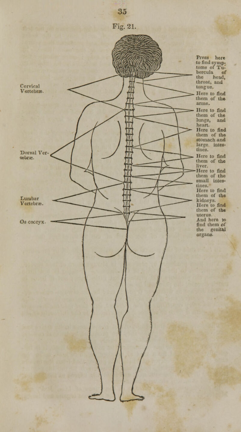 Cervical Vertebr.-e Lumbar Vertebras Os coccyx Here to find them of the lungs, and heart. Here to find them of the stomach and large intes- tines. Here to find them of the liver. Here to find them of the small intes- tines. Here to find them of the kidneys. Here to find them of the uterus. And here 50 find them of the genital organs.