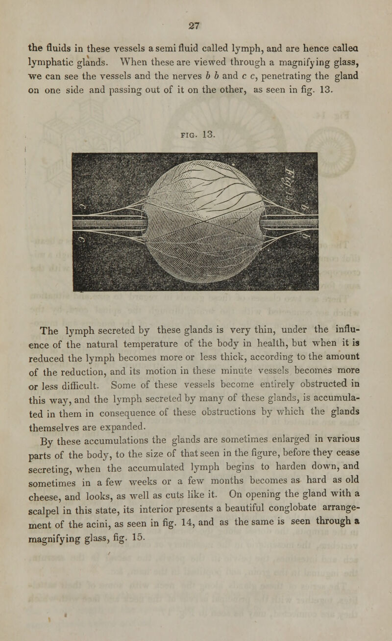 the fluids in these vessels a semi fluid called lymph, and are hence callea lymphatic glands. When these are viewed through a magnifying glass, we can see the vessels and the nerves b b and c c, penetrating the gland on one side and passing out of it on the other, as seen in fig. 13. fig. 13. The lymph secreted by these glands is very thin, under the influ- ence of the natural temperature of the body in health, but when it is reduced the lymph becomes more or less thick, according to the amount of the reduction, and its motion in these minute vessels becomes more or less difficult. Some of these vessels become entirely obstructed in this way, and the lymph secreted by many of these glands, is accumula- ted in them in consequence of these obstructions by which the glands themselves are expanded. By these accumulations the glands are sometimes enlarged in various parts of the body, to the size of that seen in the figure, before they cease secreting, when the accumulated lymph begins to harden down, and sometimes in a few weeks or a few months becomes as hard as old cheese, and looks, as well as cuts like it. On opening the gland with a scalpel in this state, its interior presents a beautiful conglobate arrange- ment of the acini, as seen in fig. 14, and as the same is seen through a magnifying glass, fig. 15.