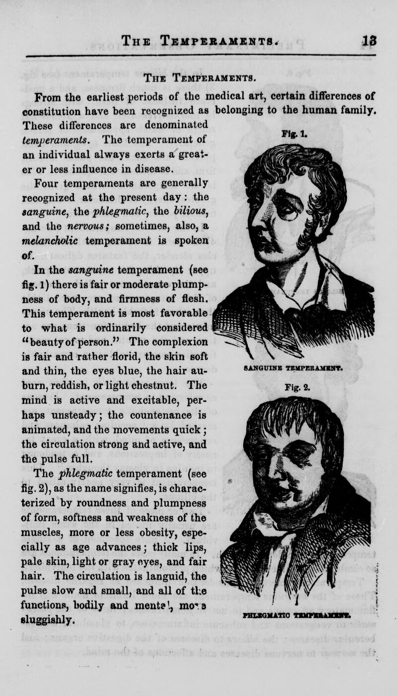 Fig. 1. The Temperaments. From the earliest periods of the medical art, certain differences of constitution have been recognized as belonging to the human family. These differences are denominated temperaments. The temperament of an individual always exerts a great- er or less influence in disease. Four temperaments are generally recognized at the present day: the sanguine, the phlegmatic, the bilious, and the nervous; sometimes, also, a melancholic temperament is spoken of. In the sanguine temperament (see fig. l) there is fair or moderate plump- ness of body, and firmness of flesh. This temperament is most favorable to what is ordinarily considered beauty of person. The complexion is fair and rather florid, the skin soft and thin, the eyes blue, the hair au- burn, reddish, or light chestnut. The mind is active and excitable, per- haps unsteady; the countenance is animated, and the movements quick; the circulation strong and active, and the pulse full. The phlegmatic temperament (see fig. 2), as the name signifies, is charac- terized by roundness and plumpness of form, softness and weakness of the muscles, more or less obesity, espe- cially as age advances; thick lips, pale skin, light or gray eyes, and fair hair. The circulation is languid, the pulse slow and small, and all of the functions, bodily and mente'., moT a SANGUINE TEMPERAMENT. Fig. 2.