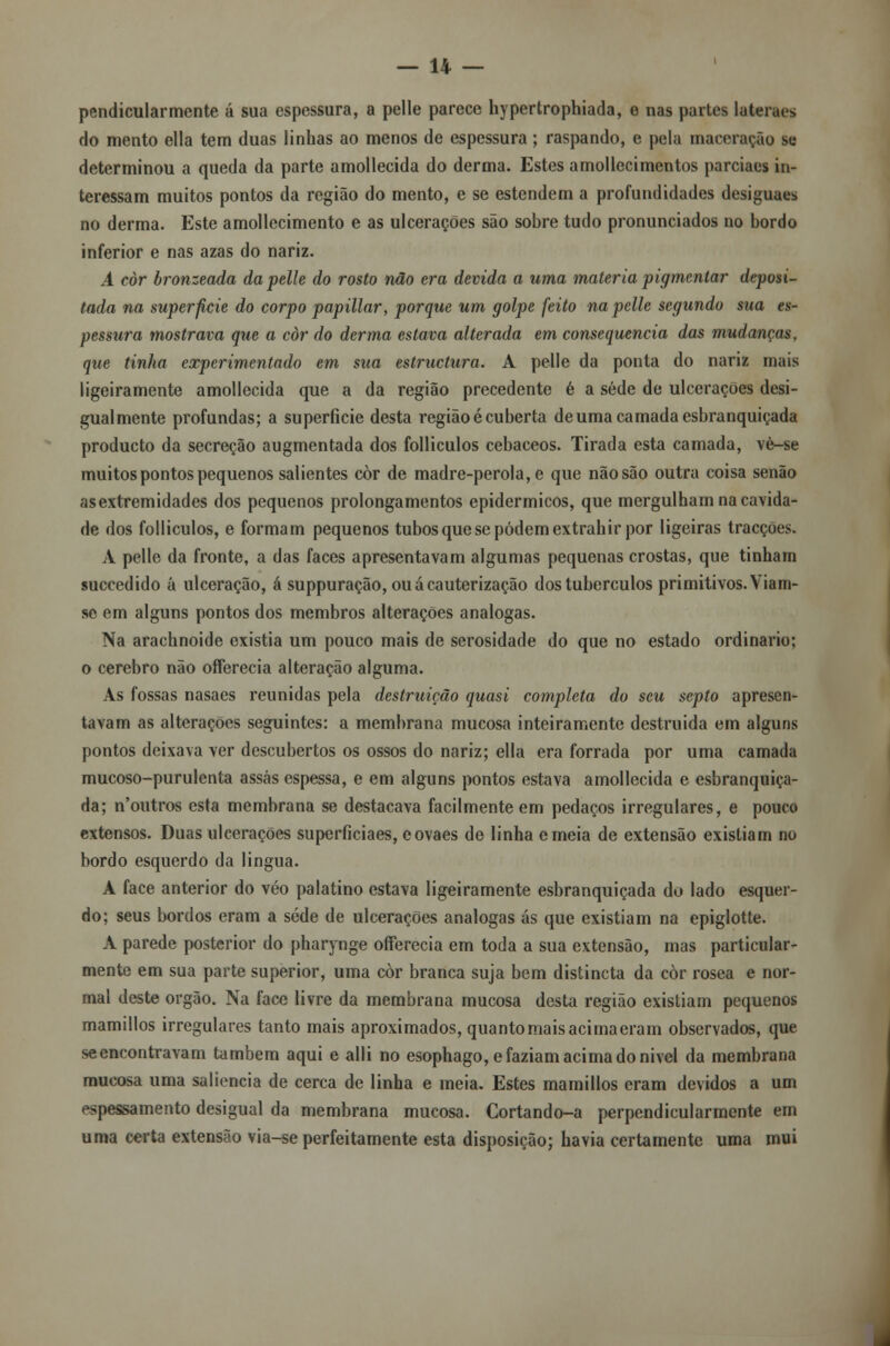 pendicularmente á sua espessura, a pelle parece hypertrophiada, e nas partes latentes do mento ella tem duas linhas ao menos de espessura ; raspando, e pela maceração se determinou a queda da parte amollecida do derma. Estes amollecimentos parciaes in- teressam muitos pontos da região do mento, e se estendem a profundidades desiguaes no derma. Este amollecimento e as ulcerações são sobre tudo pronunciados no bordo inferior e nas azas do nariz. A còr bronzeada da pelle do rosto não era devida a uma matéria pigmentar deposi- tada na superfície do corpo papillar, porque um golpe feito na pelle segundo sua es- pessura mostrava que a còr do derma estava alterada em consequência das mudanças, que tinha experimentado em sua estructura. A pelle da ponta do nariz mais ligeiramente amollecida que a da região precedente é a sede de ulcerações desi- gualmente profundas; a superfície desta região écuberta de uma camada esbranquiçada producto da secreção augmentada dos folliculos cebaceos. Tirada esta camada, vè-se muitos pontos pequenos salientes còr de madre-perola,e que não são outra coisa senão as extremidades dos pequenos prolongamentos epidérmicos, que mergulham na cavida- de dos folliculos, e formam pequenos tubos que se podem extrahir por ligeiras tracções. A pelle da fronte, a das faces apresentavam algumas pequenas crostas, que tinham succedido á ulceração, á suppuração, ou á cauterização dos tubérculos primitivos. Viam- se em alguns pontos dos membros alterações análogas. Na arachnoide existia um pouco mais de serosidade do que no estado ordinário; o cérebro não onerccia alteração alguma. As fossas nasaes reunidas pela destruição quasi completa do seu septo apresen- tavam as alterações seguintes: a membrana mucosa inteiramente destruída em alguns pontos deixava ver descubertos os ossos do nariz; ella era forrada por uma camada mucoso-purulenta assas espessa, e em alguns pontos estava amollecida e esbranquiça- da; n'outros esta membrana se destacava facilmente em pedaços irregulares, e pouco extensos. Duas ulcerações superficiaes, covaes de linha emeia de extensão existiam no bordo esquerdo da lingua. A face anterior do véo palatino estava ligeiramente esbranquiçada do lado esquer- do; seus bordos eram a sede de ulcerações análogas ás que existiam na epiglotte. A parede posterior do pharynge offerecia em toda a sua extensão, mas particular- mente em sua parte superior, uma còr branca suja bem distincta da còr rósea e nor- mal deste órgão. Na face livre da membrana mucosa desta região existiam pequenos mamillos irregulares tanto mais aproximados, quantomaisacimaeram observados, que seencontravam também aqui e alli no esophago, e faziam acima do nivel da membrana mucosa uma saliência de cerca de linha e meia. Estes mamillos eram devidos a um espessamento desigual da membrana mucosa. Cortando-a perpendicularmente ern uma certa extensão via-se perfeitamente esta disposição; havia certamente uma mui