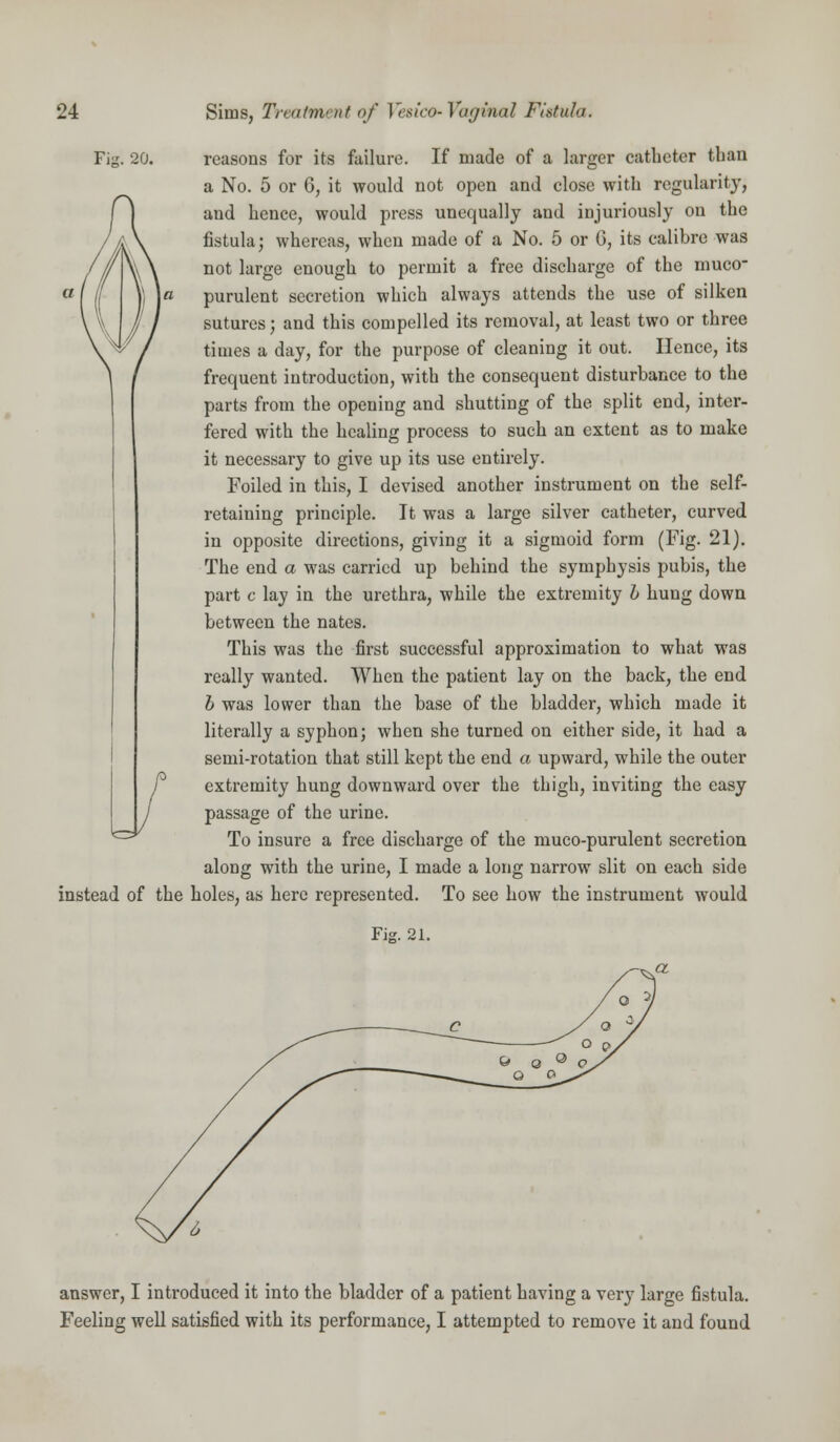 Fig. 20. reasons for its failure. If made of a larger catheter than a No. 5 or 6, it would not open and close with regularity, and hence, would press unequally and injuriously on the fistula; whereas, when made of a No. 5 or G, its calibre was not large enough to permit a free discharge of the muco- purulent secretion which always attends the use of silken sutures; and this compelled its removal, at least two or three times a day, for the purpose of cleaning it out. Hence, its frequent introduction, with the consequent disturbance to the parts from the opening and shutting of the split end, inter- fered with the healing process to such an extent as to make it necessary to give up its use entirely. Foiled in this, I devised another instrument on the self- retaining principle. It was a large silver catheter, curved in opposite directions, giving it a sigmoid form (Fig. 21). The end a was carried up behind the symphysis pubis, the part c lay in the urethra, while the extremity h hung down between the nates. This was the first successful approximation to what was really wanted. When the patient lay on the back, the end h was lower than the base of the bladder, which made it literally a syphon; when she turned on either side, it had a semi-rotation that still kept the end a upward, while the outer extremity hung downward over the thigh, inviting the easy passage of the urine. To insure a free discharge of the muco-purulent secretion along with the urine, I made a long narrow slit on each side instead of the holes, as here represented. To see how the instrument would Fig. 21. answer, I introduced it into the bladder of a patient having a very large fistula. Feeling well satisfied with its performance, I attempted to remove it and found