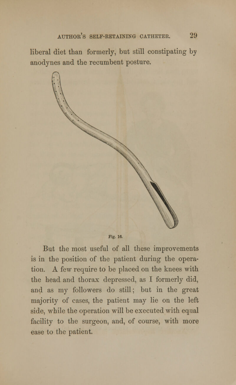 liberal diet than formerly, but still constipating by anodynes and the recumbent posture. Fig. 16. But the most useful of all these improvements is in the position of the patient during the opera- tion. A few require to be placed on the knees with the head and thorax depressed, as I formerly did, and as my followers do still; but in the great majority of cases, the patient may lie on the left side, while the operation will be executed with equal facility to the surgeon, and, of course, with more ease to the patient.