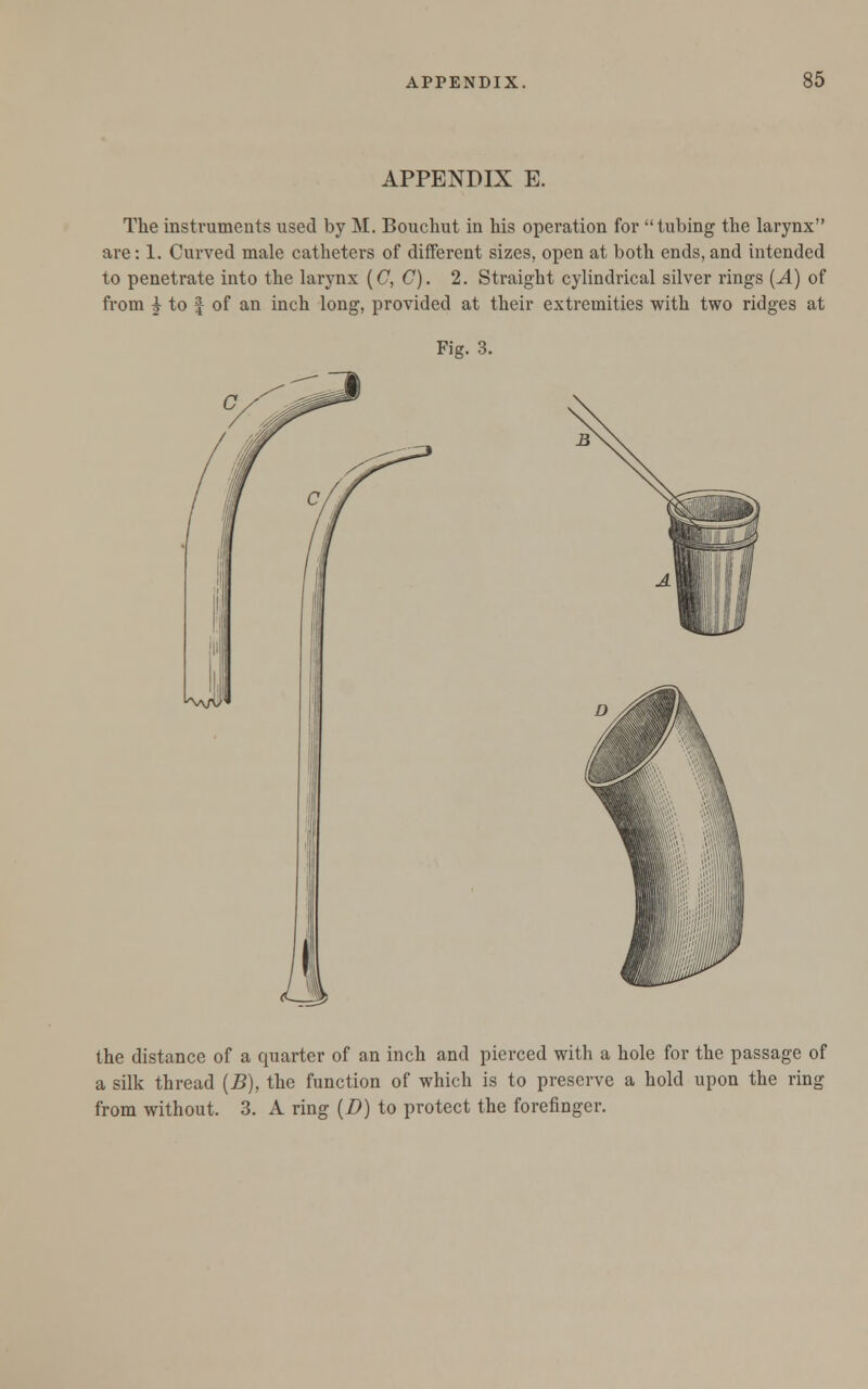 APPENDIX E. The instruments used by M. Bouchut in his operation for tubing the larynx are: 1. Curved male catheters of different sizes, open at both ends, and intended to penetrate into the larynx (C, C). 2. Straight cylindrical silver rings (A) of from i to J of an inch long, provided at their extremities with two ridges at the distance of a quarter of an inch and pierced with a hole for the passage of a silk thread (B), the function of which is to preserve a hold upon the ring from without. 3. A ring (D) to protect the forefinger.