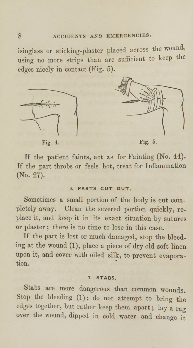 isinglass or sticking-plaster placed across the wound, using no more strips than are sufficient to keep the edges nicely in contact (Fig. 5). Fig. 4. If the patient faints, act as for Fainting (No. 44). If the part throbs or feels hot, treat for Inflammation (No. 27). 6. PARTS CUT OUT. Sometimes a small portion of the body is cut com- pletely away. Clean the severed portion quickly, re- place it, and keep it in its exact situation by sutures or plaster; there is no time to lose in this case. If the part is lost or much damaged, stop the bleed- ing at the wound (1), place a piece of dry old soft linen upon it, and cover with oiled silk, to prevent evapora- tion. 7. STABS. Stabs are more dangerous than common wounds. Stop the bleeding (1); do not attempt to bring the edges together, but rather keep them apart; lay a ra<* over the Avound, dipped in cold water and change it