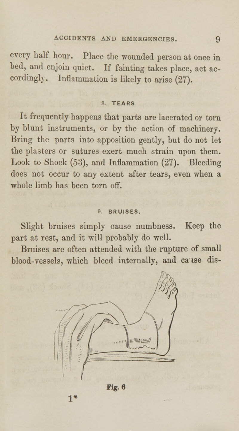 every half hour. Place the wounded person at once in bed, and enjoin quiet. If fainting takes place, act ac- cordingly. Inflammation is likely to arise (27). It frequently happens that parts are lacerated or torn by blunt instruments, or by the action of machinery. Bring the parts into apposition gently, but do not let the plasters or sutures exert much strain upon them. Look to Shock (53), and Inflammation (27). Bleeding does not occur to any extent after tears, even when a whole limb has been torn off. BRUISES. Slight bruises simply cause numbness. Keep the part at rest, and it will probably do well. Bruises are often attended with the rupture of small blood-vessels, which bleed internally, and ca ise dis-