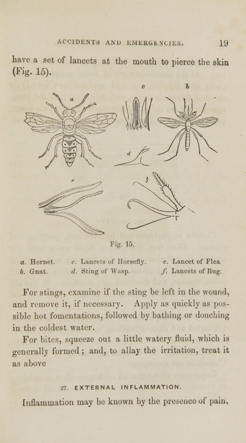 have a set of lancets at the mouth to pierce the akin (Fig. 15). ''*££?» Fie. 15. a. Hornet. 6. Gnat. c. Lancets of Horsefly. d. Sting of Wasp. e. Lancet of Flea. f. Lancets of Bug. For stings, examine if the sting be left in the wound, and remove it, if necessary. Apply as quickly as pos- sible hot fomentations, followed by bathing or douching in the coldest water. For bites, squeeze out a little watery fluid, which is generally formed; and, to allay the irritation, treat it as above ■XI. EXTERNAL INFLAMMATION. Inflammation may be known by the presence of pain,