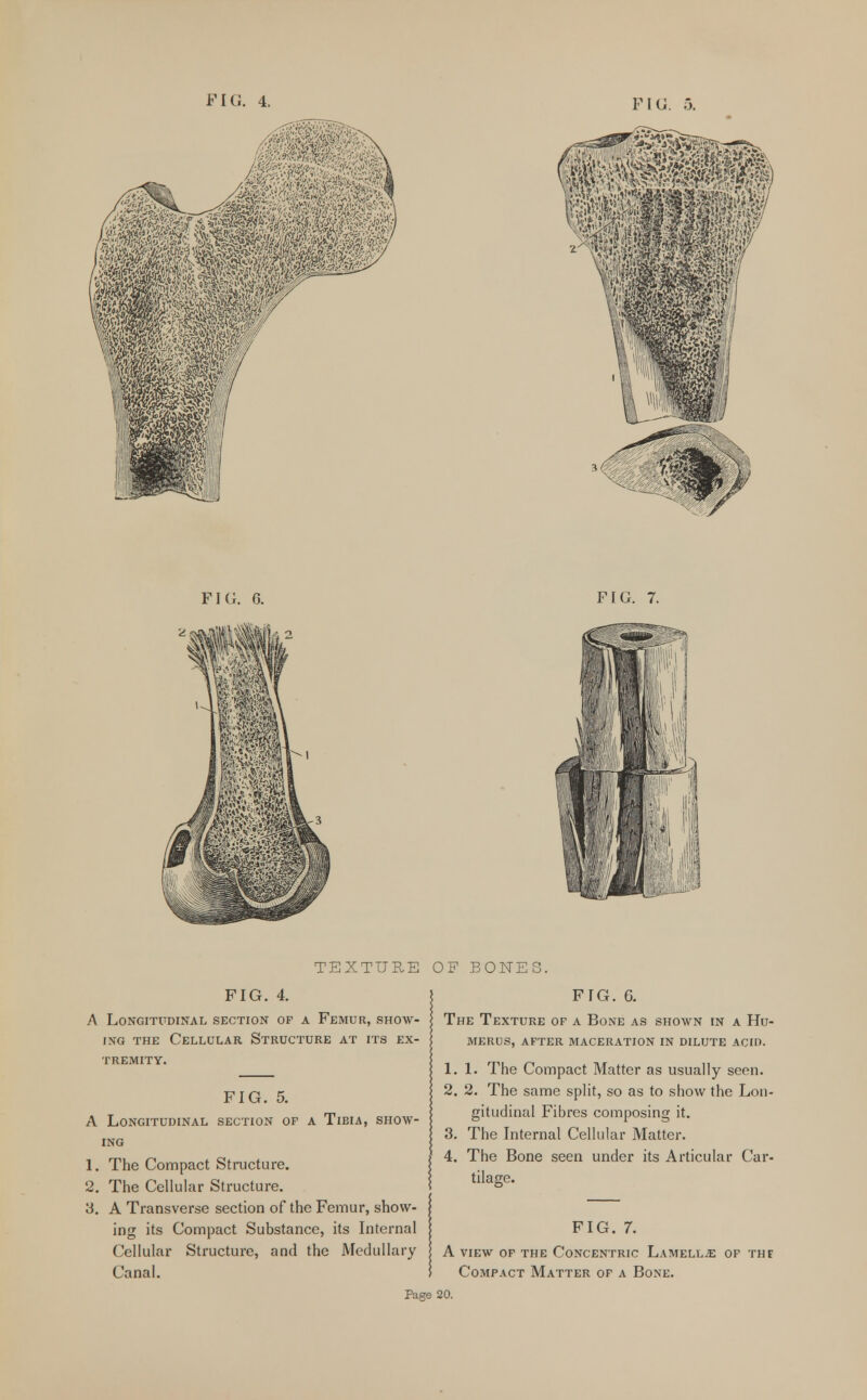 FIG. FIG. 6. FIG. 7. TEXTURE FIG. 4. A LONGITUDINAL SECTION OP A FEMUR, SHOW- ING the Cellular Structure at its ex- tremity. FIG. 5. A Longitudinal section of a Tibia, show- ing 1. The Compact Structure. 2. The Cellular Structure. 3. A Transverse section of the Femur, show- ing its Compact Substance, its Internal Cellular Structure, and the Medullary Canal. OF BONES. FIG. 6. The Texture of a Bone as shown in a Hu- merus, after maceration in dilute acid. 1.1. The Compact Matter as usually seen. 2. 2. The same split, so as to show the Lon- gitudinal Fibres composing it. 3. The Internal Cellular Matter. 4. The Bone seen under its Articular Car- tilage. FIG. 7. A view of the Concentric Lamellae of thf Compact Matter of a Bone. 20.