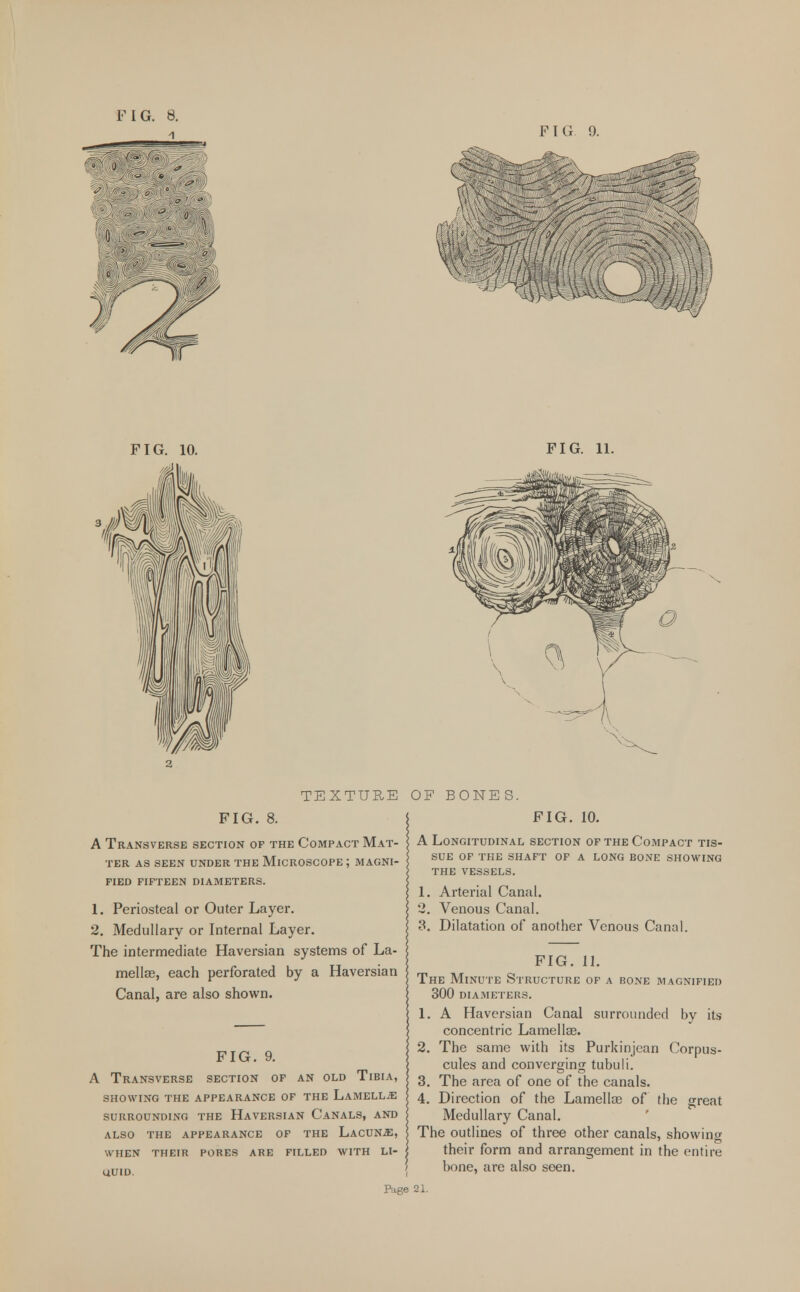 ^jwws^3^-^ FIG. 10. FIG. 11. TEXTURE OF BONES. PIG. 8. A Transverse section of the Compact Mat- FIG. 10. TER AS SEEN UNDER THE MICROSCOPE ; MAGNI- FIED FIFTEEN DIAMETERS. 1. Periosteal or Outer Layer. 2. Medullary or Internal Layer. The intermediate Haversian systems of La- mella?, each perforated by a Haversian Canal, are also shown. A Longitudinal section of the Compact tis- sue OF THE SHAFT OF A LONG BONE SHOWING THE VESSELS. 1. Arterial Canal. 2. Venous Canal. 3. Dilatation of another Venous Canal. FIG. 11. The Minute Structure of a bone magnified 300 diameters. 1 FIG. 9. A Transverse section of an old Tibia, SHOWING THE APPEARANCE OF THE LAMELLAE SURROUNDING THE HAVERSIAN CANALS, AND ALSO THE APPEARANCE OF THE LaCUNE, WHEN THEIR PORES ARE FILLED WITH LI- UUID. Page A Haversian Canal surrounded by its concentric Lamellae. 2. The same with its Purkinjean Corpus- cules and converging tubuli. 3. The area of one of the canals. 4. Direction of the Lamellae of the great Medullary Canal. The outlines of three other canals, showing their form and arrangement in the entire bone, are also seen.