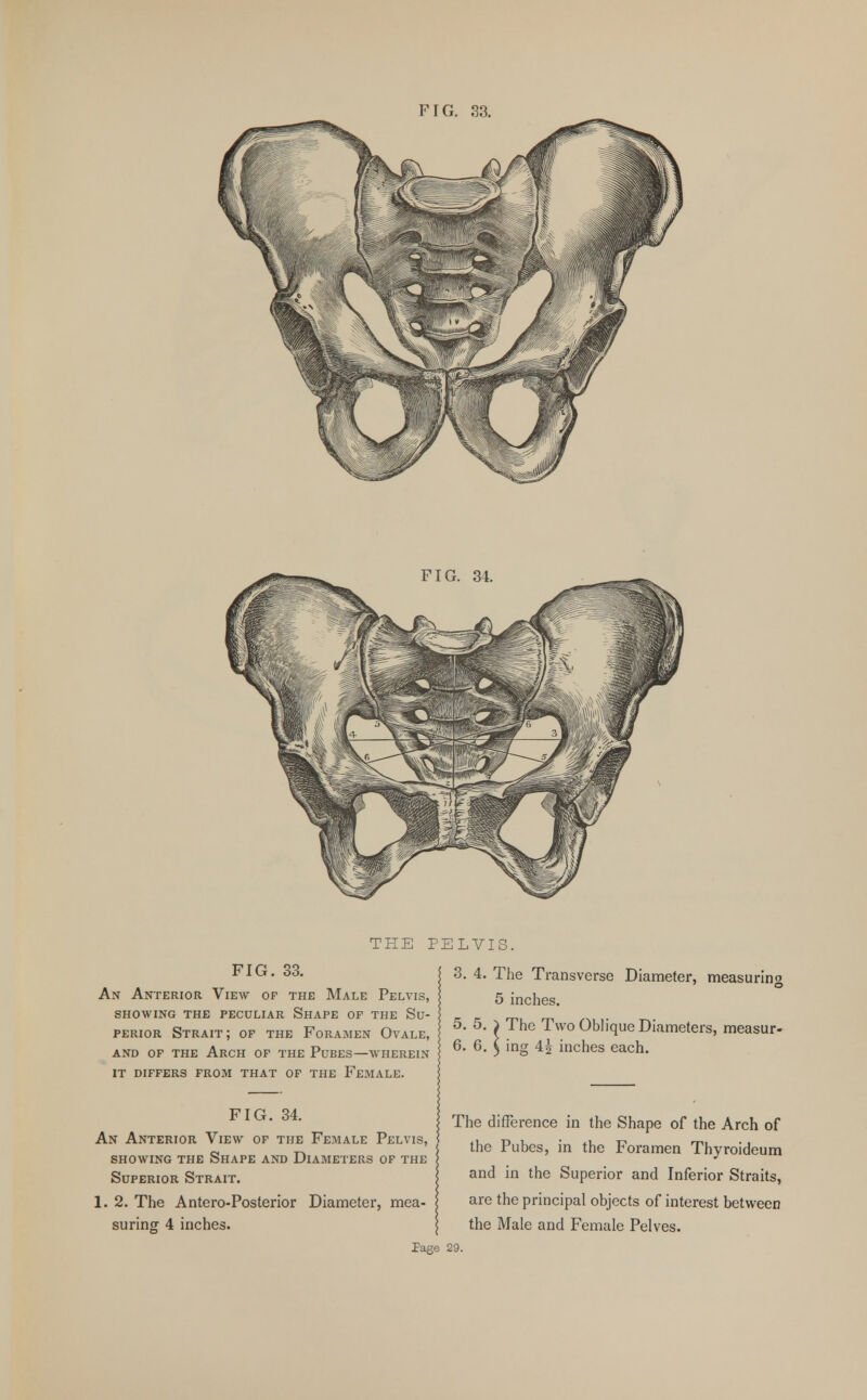FIG. 34. THE PELVIS FIG. 33. An Anterior View of the Male Pelvis, showing the peculiar shape of the su- PERIOR Strait; of the Foramen Ovale, and of the Arch of the Pubes—wherein it differs from that of the Female. 3. 4. The Transverse Diameter, measuring 5 inches. 5. 5. ) The Two Oblique Diameters, measur- 6. 6. ( ing 4| inches each. FIG. 34. An Anterior View of the Female Pelvis, showing the Shape and Diameters of the Superior Strait. 1. 2. The Antero-Posterior Diameter, mea- suring 4 inches. The difference in the Shape of the Arch of the Pubes, in the Foramen Thyroideum and in the Superior and Inferior Straits, are the principal objects of interest between the Male and Female Pelves.