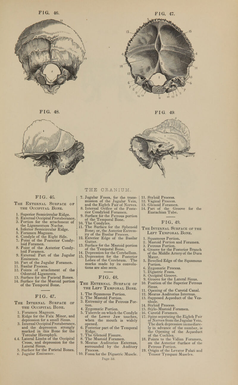 FIG. 48. FIG. 49. FIG. 46. The External Surface of the Occipital Bone. 1. Superior Semicircular Ridge. 2. External Occipital Protuberance. 3. Portion for the attachment of the Ligamentum Nuchae. 4. Inferior Semicircular Ridge. 5. Foramen Magnum. 6. Condyle of the Right Side. 7. Point of the Posterior Condy- loid Foramen. 8. Point of the Anterior Condy- loid Foramen. 9. External Part of the Jugular Eminence. 10. Part of the Jugular Foramen. 11. Basilar Process. 12. Points of attachment of the Odontoid Ligaments. 13. Surface for the Parietal Bones. 14. Surface for the Mastoid portion of the Temporal Bone. FIG. 47. The Internal Surface of the Occipital Bone. 1. Foramen Magnum. 2. Ridge for the Falx Minor, and depression for a small Sinus. 3. Internal Occipital Protuberance, and the depression strongly marked in this Bone for the Torcular Hierophyli. 4.4. Lateral Limbs of the Occipital Cross, and depression for the Lateral Sinus. 5. Surface for the Parietal Bones. (i. Jugular Eminence. THE CRANIUM. . Jugular Fossa, for the trans- mission of the Jugular Vein, and the Eighth Pair of Nerves. . Internal Orifice of the Poste- rior Condyloid Foramen. . Surface for the Petrous portion of the Temporal Bone. 10. The Condyles. 11. The Surface for the Sphenoid j Bone; or, the Anterior Extrem- \ ity of the Basilar Process. | 12. Exterior Edge of the Basilar < Gutter. I 13. Surface for the Mastoid portion of the Temporal Bone. 14. Depression for the Cerebellum. 15. Depression for the Posterior Lobes of the Cerebrum. The marks made by its convolu- tions are also seen. FIG. 48. The External Surface of the Left Temporal Bone. 1. The Squamous Portion. 2. The Mastoid Portion. 3. Extremity of the Petrous Por- tion. 4. Zygomatic Portion. 5. Tubercle on which the Condyle of the Lower Jaw touches, when the mouth is widely opened. 6. Posterior part of the Temporal Ridge. 7. The Glenoid Fissure. 8. The Mastoid Foramen. 9. Meatus Auditorius Externus, surrounded by the Auditory Process. 10. Fossa for the Digastric Muscle. Page 33. 11. Styloid Process. 12. Vaginal Process. 13. Glenoid Foramen. 14. Part of the Groove for the Eustachian Tube. FIG. 49. The Internal Surface of the Left Temporal Bone. 1. Squamous Portion. 2. Mastoid Portion and Foramen. 3. Petrous Portion. 4. Groove for the Posterior Branch of the Middle Artery of the Dura Mater. 5. Bevelled Edge of the Squamous Portion. 6. Zygomatic Process. 7. Digastric Fossa. 8. Occipital Groove. 9. Groove for the Lateral Sinus. 10. Position of the Superior Petrous Sinus. 11. Opening of the Carotid Canal. 12. Meatus Auditorius Internus. 13. Supposed Aqueduct of the Ves- tibule. 14. Styloid Process. 15. Stylo-Mastoid Foramen. 16. Carotid Foramen. 17. Spine separating the Eighth Pair of Nerves from the Jugular Vein. The dark depression immediate- ly in advance of the number, is the Opening of the Aqueduct of the Cochlea. 18. Points to the Vidian Foramen, on the Anterior Surface of the Petrous Portion. 19. Origin of the Levator Palati and Tensor Tympani Muscles.