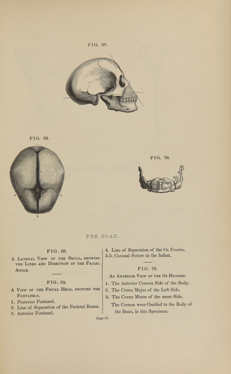 FIG. 69. FIG. 70. THE HEAD. FIG. 68. A Lateral View of the Skull, showing the Lines and Direction of the Facial Angle. FIG. 69. A View of the Fcetal Head, showing the Fontanels. 1. Posterior Fontanel. 2. Line of Separation of the Parietal Bones. 3. Anterior Fontanel. 4. Line of Separation of the Os Frontis. 5.5. Coronal Suture in the Infant. FIG. 70. An Anterior View of the Os Hyoides. 1. The Anterior Convex Side of the Body. 2. The Cornu Majus of the Left Side. 3. The Cornu Minus of the same Side. The Cornua were Ossified to the Body of the Bone, in this Specimen.
