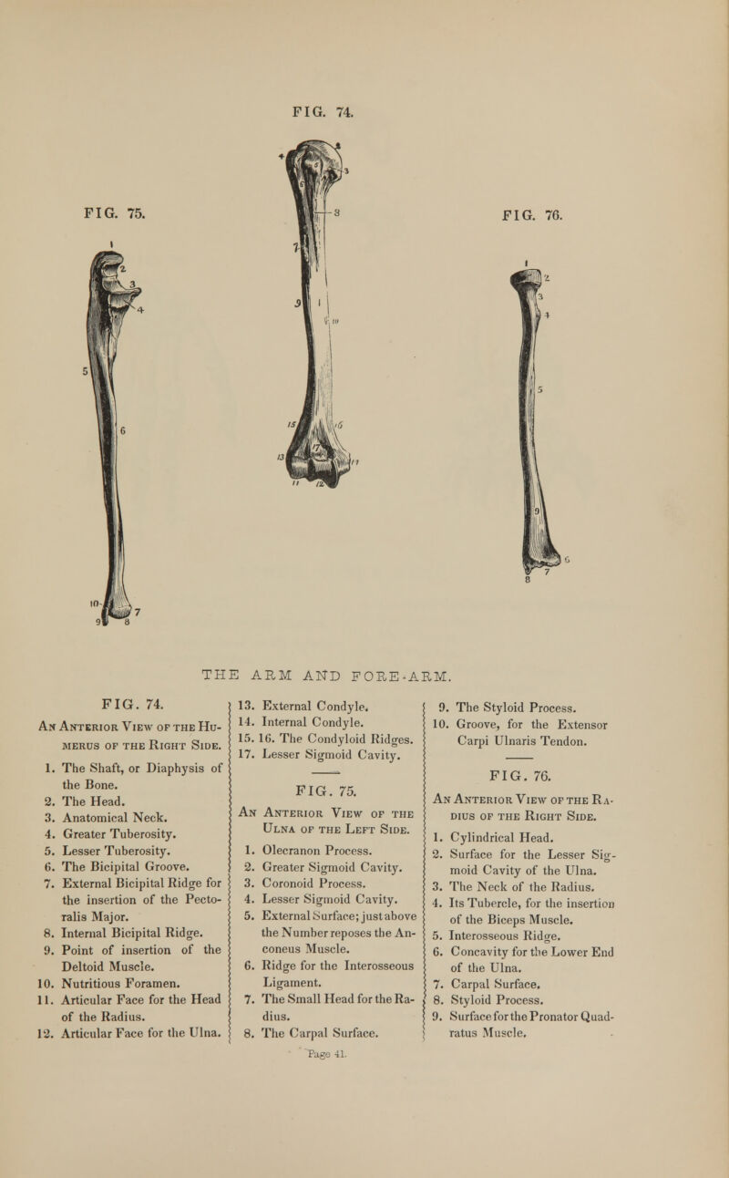 FIG. 75. FIG. 76. THE ARM AND FORE-ARM. FIG. 74. An Anterior View of the Hu- merus of the Right Side. 1. The Shaft, or Diaphysis of the Bone. 2. The Head. 3. Anatomical Neck. 4. Greater Tuberosity. 5. Lesser Tuberosity. 6. The Bicipital Groove. 7. External Bicipital Ridge for the insertion of the Pecto- ralis Major. 8. Internal Bicipital Ridge. 9. Point of insertion of the Deltoid Muscle. 10. Nutritious Foramen. 11. Articular Face for the Head of the Radius. 12. Articular Face for the Ulna. 13. External Condyle. 14. Internal Condyle. 15. 16. The Condyloid Ridges. 17. Lesser Sigmoid Cavity. FIG. 75. An Anterior View of the Ulna of the Left Side. 1. Olecranon Process. 2. Greater Sigmoid Cavity. 3. Coronoid Process. 4. Lesser Sigmoid Cavity. 5. External Surface; just above the Number reposes the An- coneus Muscle. 6. Ridge for the Interosseous Ligament. 7. The Small Head for the Ra- dius. 8. The Carpal Surface. ' 'Page 41. 9. The Styloid Process. 10. Groove, for the Extensor Carpi Ulnaris Tendon. FIG. 76. An Anterior View of the Ra- dius of the Right Side. 1. Cylindrical Head. 2. Surface for the Lesser Sig- moid Cavity of the Ulna. 3. The Neck of the Radius. 4. Its Tubercle, for the insertion of the Biceps Muscle. 5. Interosseous Ridge. 6. Concavity for the Lower End of the Ulna. 7. Carpal Surface. 8. Styloid Process. 9. Surface for the Pronator Quad- ratus Muscle.
