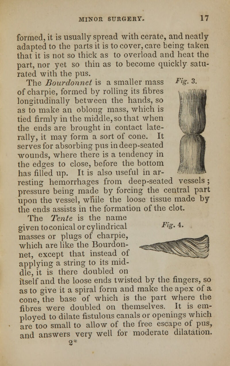 Fig. 3. formed, it is usually spread with cerate, and neatly- adapted to the parts it is to cover, care being taken that it is not so thick as to overload and heat the part, nor yet so thin as to become quickly satu- rated with the pus. The Bourdonnet is a smaller mass of charpie, formed by rolling its fibres longitudinally between the hands, so as To make an oblong mass, which is tied firmly in the middle, so that when the ends are brought in contact late- rally, it may form a sort of cone. It serves for absorbing pus in deep-seated wounds, where there is a tendency in the edges to close, before the bottom has filled up. It is also useful in ar- resting hemorrhages from deep-seated vessels; pressure being made by forcing the central part upon the vessel, while the loose tissue made by the ends assists in the formation of the clot. The Tente is the name given to conical or cylindrical FlS- 4* masses or plugs of charpie, which are like the Bourdon- net, except that instead of applying a string to its mid- dle, it is there doubled on itself and the loose ends twisted by the fingers, so as to give it a spiral form and make the apex of a cone, the base of which is the part where the fibres were doubled on themselves. It is em- ployed to dilate fistulous canals or openings which are too small to allow of the free escape of pus, and answers very well for moderate dilatation.