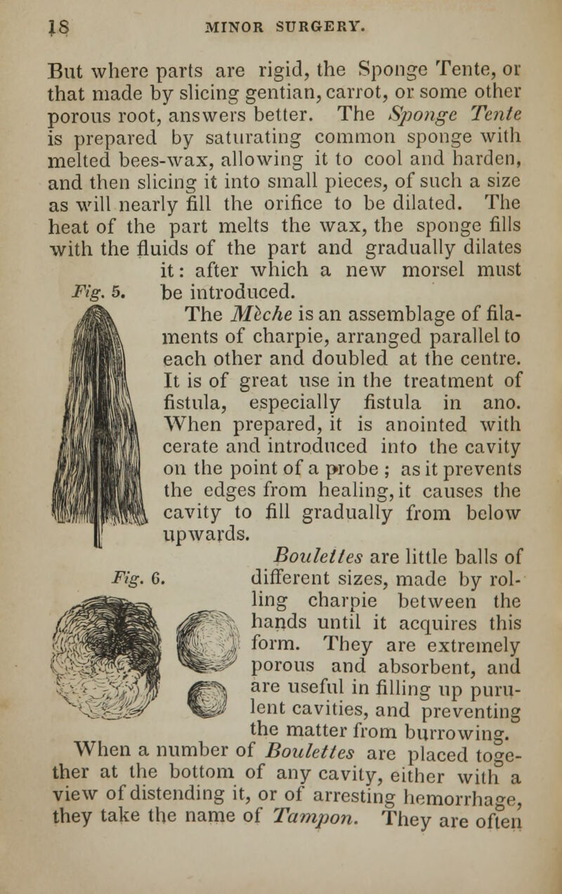 Fig. 5. But where parts are rigid, the Sponge Tente, or that made by slicing gentian, carrot, or some other porous root, answers better. The Sponge Tente is prepared by saturating common sponge with, melted bees-wax, allowing it to cool and harden, and then slicing it into small pieces, of such a size as will nearly fill the orifice to be dilated. The heat of the part melts the wax, the sponge fills with the fluids of the part and gradually dilates it: after which a new morsel must be introduced. The Mtche is an assemblage of fila- ments of charpie, arranged parallel to each other and doubled at the centre. It is of great use in the treatment of fistula, especially fistula in ano. When prepared, it is anointed with cerate and introduced into the cavity on the point of a probe ; as it prevents the edges from healing, it causes the cavity to fill gradually from below upwards. Boulelies are little balls of different sizes, made by rol- ling charpie between the hands until it acquires this form. They are extremely porous and absorbent, and are useful in filling up puru- lent cavities, and preventing the matter from burrowing. When a number of Boulettes are placed toge- ther at the bottom of any cavity, either with a view of distending it, or of arresting hemorrhage, they take the name of Tampon. They are often