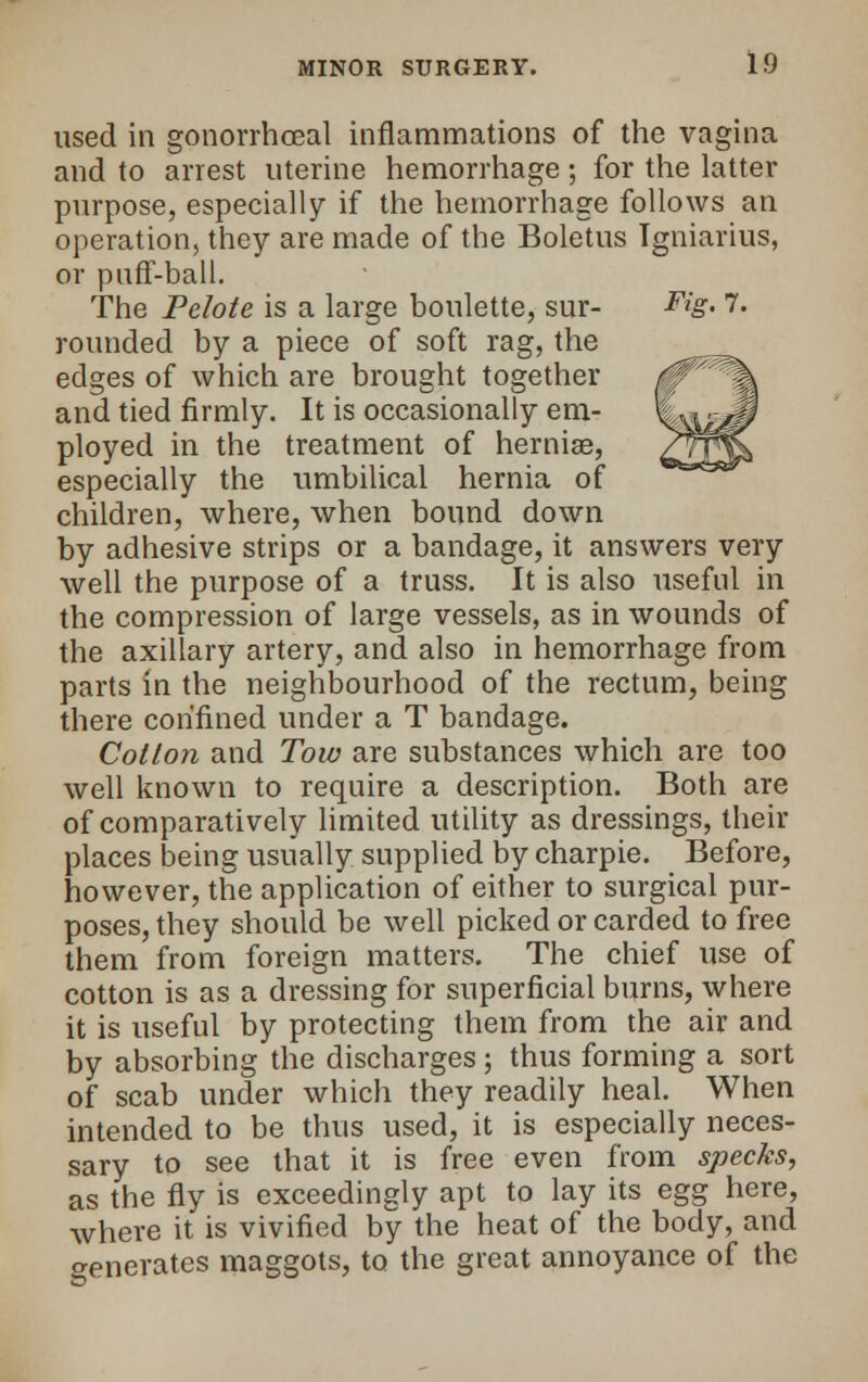 used in gonorrhoeal inflammations of the vagina and to arrest uterine hemorrhage; for the latter purpose, especially if the hemorrhage follows an operation, they are made of the Boletus Tgniarius, or puff-ball. The Pelote is a large boulette, sur- Fig. 7. rounded by a piece of soft rag, the edges of which are brought together and tied firmly. It is occasionally em- ployed in the treatment of hemiae, especially the umbilical hernia of children, where, when bound down by adhesive strips or a bandage, it answers very well the purpose of a truss. It is also useful in the compression of large vessels, as in wounds of the axillary artery, and also in hemorrhage from parts in the neighbourhood of the rectum, being there confined under a T bandage. Cotton and Tow are substances which are too well known to require a description. Both are of comparatively limited utility as dressings, their places being usually supplied by charpie. Before, however, the application of either to surgical pur- poses, they should be well picked or carded to free them from foreign matters. The chief use of cotton is as a dressing for superficial burns, where it is useful by protecting them from the air and by absorbing the discharges; thus forming a sort of scab under which they readily heal. When intended to be thus used, it is especially neces- sary to see that it is free even from specks, as the fly is exceedingly apt to lay its egg here, where it is vivified by the heat of the body, and generates maggots, to the great annoyance of the