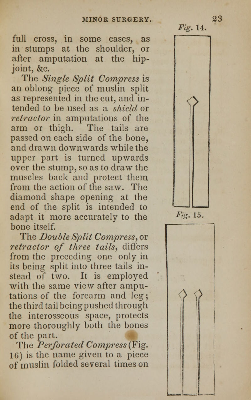 full cross, in some cases, as in stumps at the shoulder, or after amputation at the hip- joint, &c. The Single Split Compress is an oblong piece of muslin split as represented in the cut, and in- tended to be used as a shield or retractor in amputations of the arm or thigh. The tails are passed on each side of the bone, and drawn downwards while the upper part is turned upwards over the stump, so as to draw the muscles back and protect them from the action of the saw. The diamond shape opening at the end of the split is intended to adapt it more accurately to the bone itself. The Double Split Compress, or retractor of three tails, differs from the preceding one only in its being split into three tails in- stead of two. It is employed with the same view after ampu- tations of the forearm and leg; the third tailbeingpushed through the interosseous space, protects more thoroughly both the bones of the part. The Perforated Compress (Fig. 16) is the name given to a piece of muslin folded several times on Fig. 14. Fig. 15. 0 0