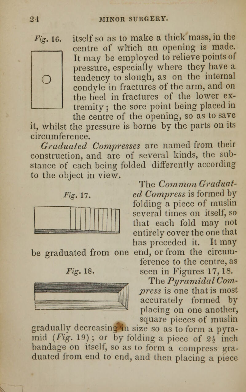 Fig. 16. itself so as to make a thick mass, in the centre of which an opening is made. It may be employed to relieve points of pressure, especially where they have a tendency to slough, as on the internal condyle in fractures of the arm, and on the heel in fractures of the lower ex- tremity ; the sore point being placed in the centre of the opening, so as to save it, whilst the pressure is borne by the parts on its circumference. Graduated Compresses are named from their construction, and are of several kinds, the sub- stance of each being folded differently according to the object in view. The Common Graduat- ed Compi^ess is formed by folding a piece of muslin several times on itself, so that each fold may not entirely cover the one that has preceded it. It may be graduated from one end, or from the circum- ference to the centre, as The Pyramidal Com- press is one that is most accurately formed by placing on one another, square pieces of muslin gradually decreasiniptn size so as to form a pyra- mid {Fig. 19) ; or by folding a piece of 2\ inch bandage on itself, so as to form a compress gra- duated from end to end, and then placing a piece Fig. 17.
