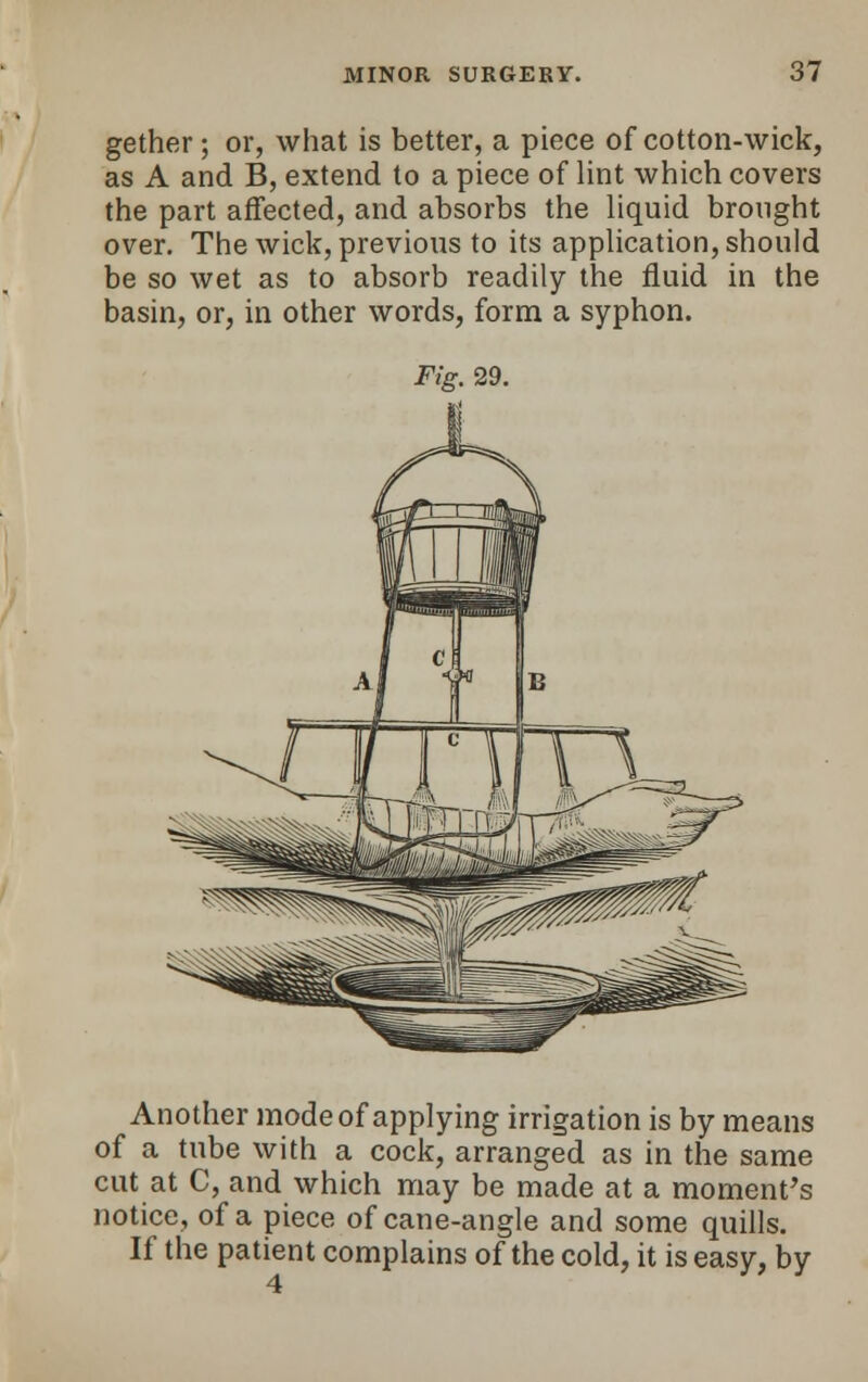 gether; or, what is better, a piece of cotton-wick, as A and B, extend to a piece of lint which covers the part affected, and absorbs the liquid brought over. The wick, previous to its application, should be so wet as to absorb readily the fluid in the basin, or, in other words, form a syphon. Fig. 29. Another mode of applying irrigation is by means of a tube with a cock, arranged as in the same cut at C, and which may be made at a moment's notice, of a piece of cane-angle and some quills. If the patient complains of the cold, it is easy, by