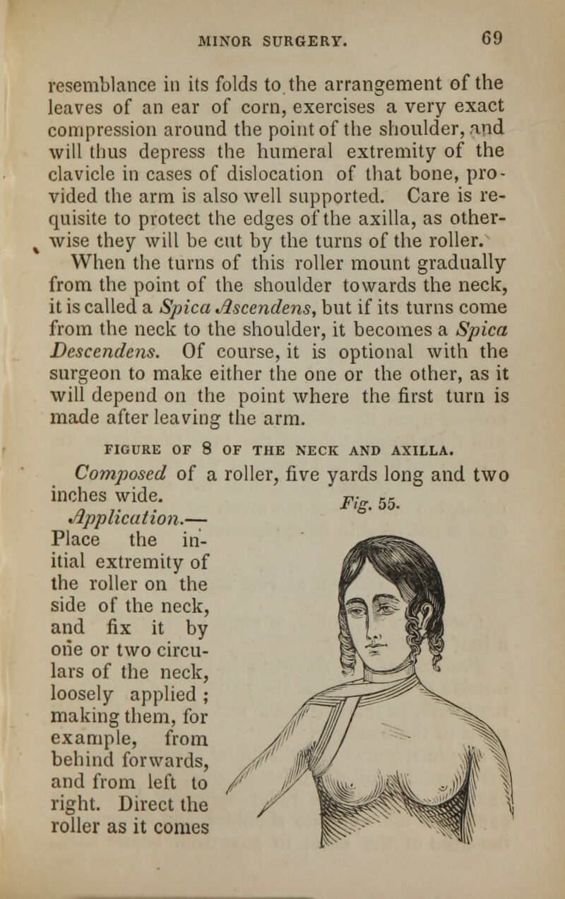 resemblance in its folds to the arrangement of the leaves of an ear of corn, exercises a very exact compression around the point of the shoulder, and will thus depress the humeral extremity of the clavicle in cases of dislocation of that bone, pro- vided the arm is also well supported. Care is re- quisite to protect the edges of the axilla, as other- wise they will be cut by the turns of the roller. When the turns of this roller mount gradually from the point of the shoulder towards the neck, it is called a Spica Ascendens, but if its turns come from the neck to the shoulder, it becomes a Spica Descendens. Of course, it is optional with the surgeon to make either the one or the other, as it will depend on the point where the first turn is made after leaving the arm. FIGURE OF 8 OF THE NECK AND AXILLA. Composed of a roller, five yards long and two inches wide. Application.— Place the in- itial extremity of the roller on the side of the neck, and fix it by one or two circu- lars of the neck, loosely applied ; making them, for example, from behind forwards, and from left to right. Direct the roller as it comes