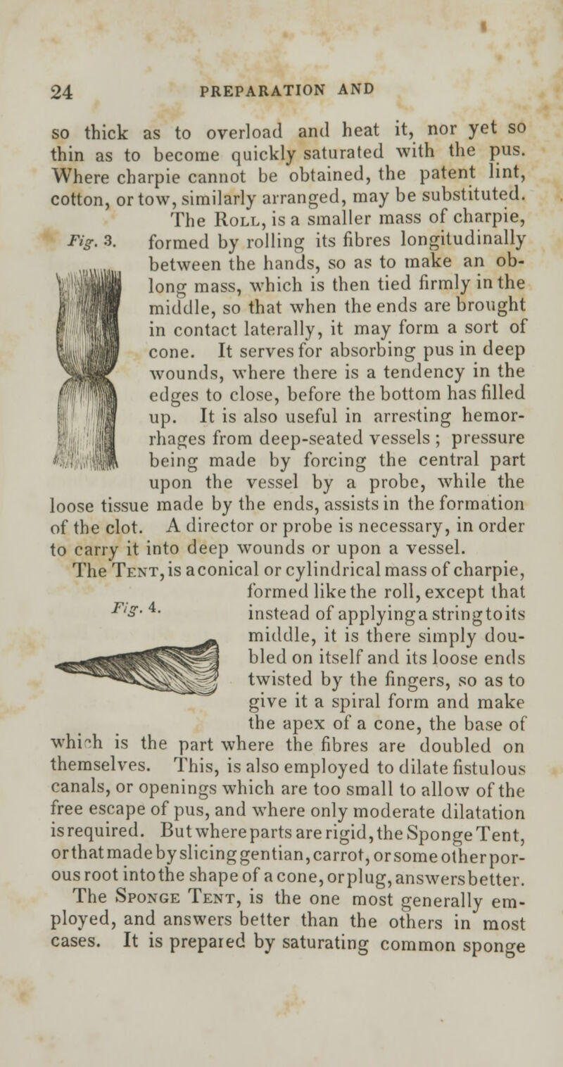 so thick as to overload and heat it, nor yet so thin as to become quickly saturated with the pus. Where charpie cannot be obtained, the patent lint, cotton, or tow, similarly arranged, may be substituted. The Roll, is a smaller mass of charpie, formed by rolling its fibres longitudinally between the hands, so as to make an ob- long mass, which is then tied firmly in the middle, so that when the ends are brought in contact laterally, it may form a sort of cone. It serves for absorbing pus in deep wounds, where there is a tendency in the edges to close, before the bottom has filled up. It is also useful in arresting hemor- rhages from deep-seated vessels ; pressure being made by forcing the central part upon the vessel by a probe, while the loose tissue made by the ends, assists in the formation of the clot. A director or probe is necessary, in order to carry it into deep wounds or upon a vessel. The Tenths aconical or cylindrical mass of charpie, formed like the roll, except that instead of applyingastringtoits middle, it is there simply dou- bled on itself and its loose ends twisted by the fingers, so as to give it a spiral form and make the apex of a cone, the base of whi~h is the part where the fibres are doubled on themselves. This, is also employed to dilate fistulous canals, or openings which are too small to allow of the free escape of pus, and where only moderate dilatation is required. But whereparts are rigid, the Sponge Tent, or that made by slicing gentian, carrot, or some other por- ous root into the shape of a cone, orplug, answersbetter. The Sponge Tent, is the one most generally em- ployed, and answers better than the others in most cases. It is prepared by saturating common sponge Fit